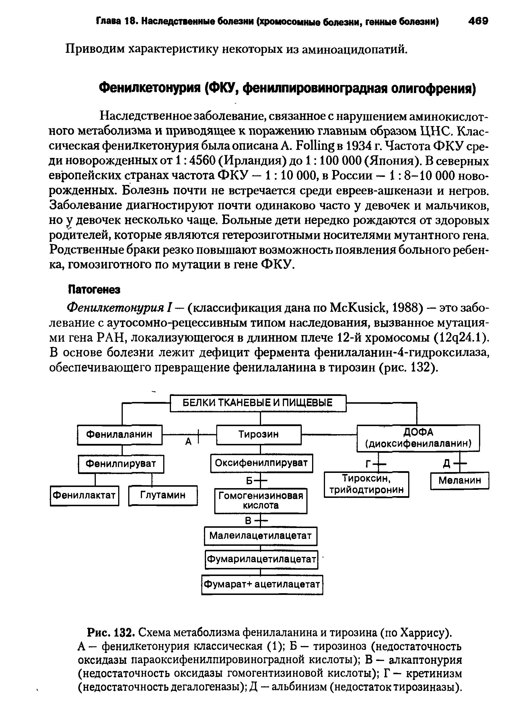 Рис. 132. Схема метаболизма фенилаланина и тирозина (по Харрису). А — фенилкетонурия классическая (1) Б — тирозиноз (недостаточность оксидазы параоксифенилпировиноградной кислоты) В — алкаптонурия (недостаточность оксидазы гомогентизиновой кислоты) Г — кретинизм (недостаточность дегалогеназы) Д — альбинизм (недостаток тирозиназы).