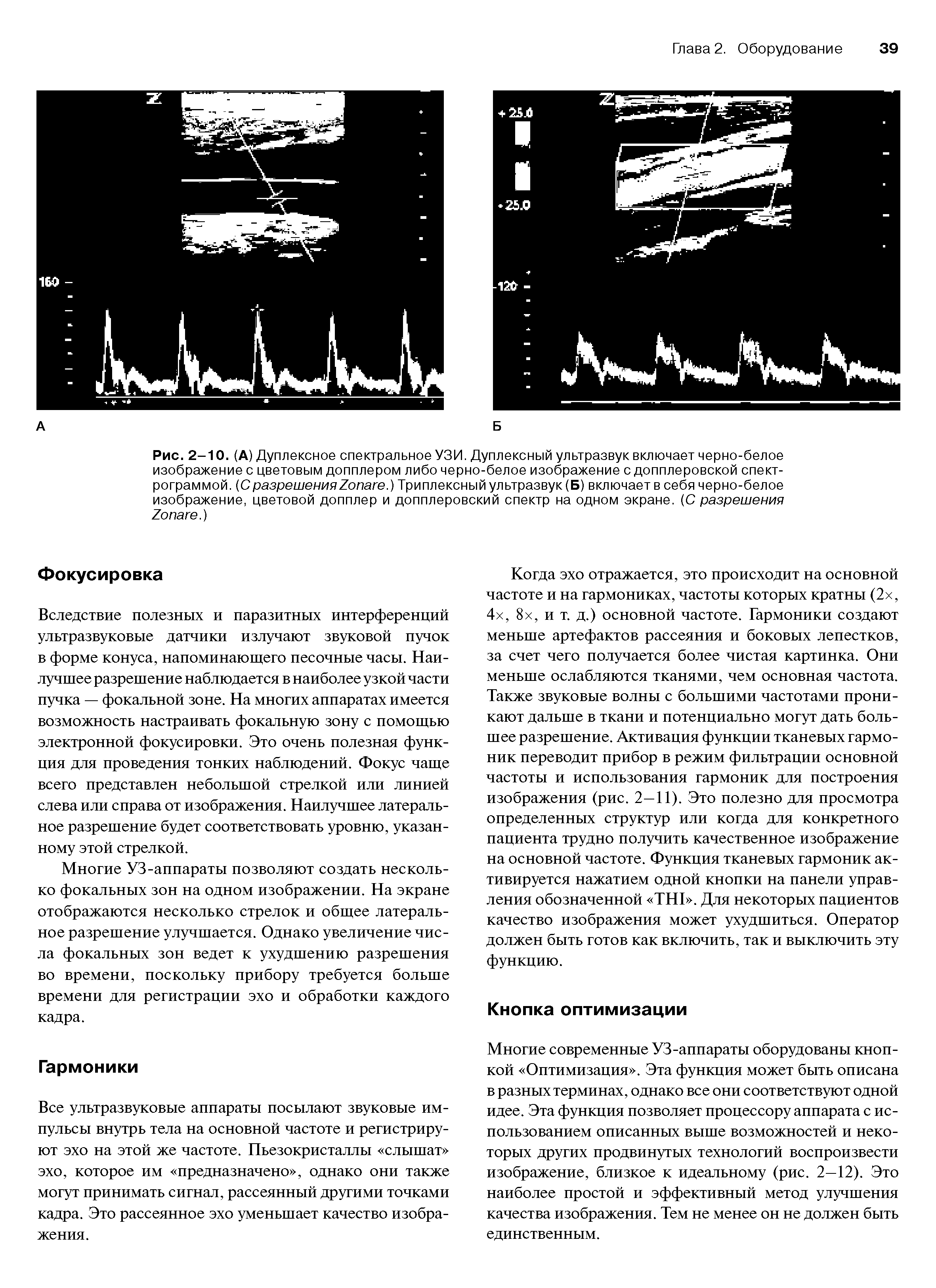 Рис. 2-10. (А) Дуплексное спектральное УЗИ. Дуплексный ультразвук включает черно-белое изображение с цветовым допплером либо черно-белое изображение с допплеровской спектрограммой. (С разрешения Z .) Триплексный ультразвук (Б) включает в себя черно-белое изображение, цветовой допплер и допплеровский спектр на одном экране. (С разрешения Z .)...