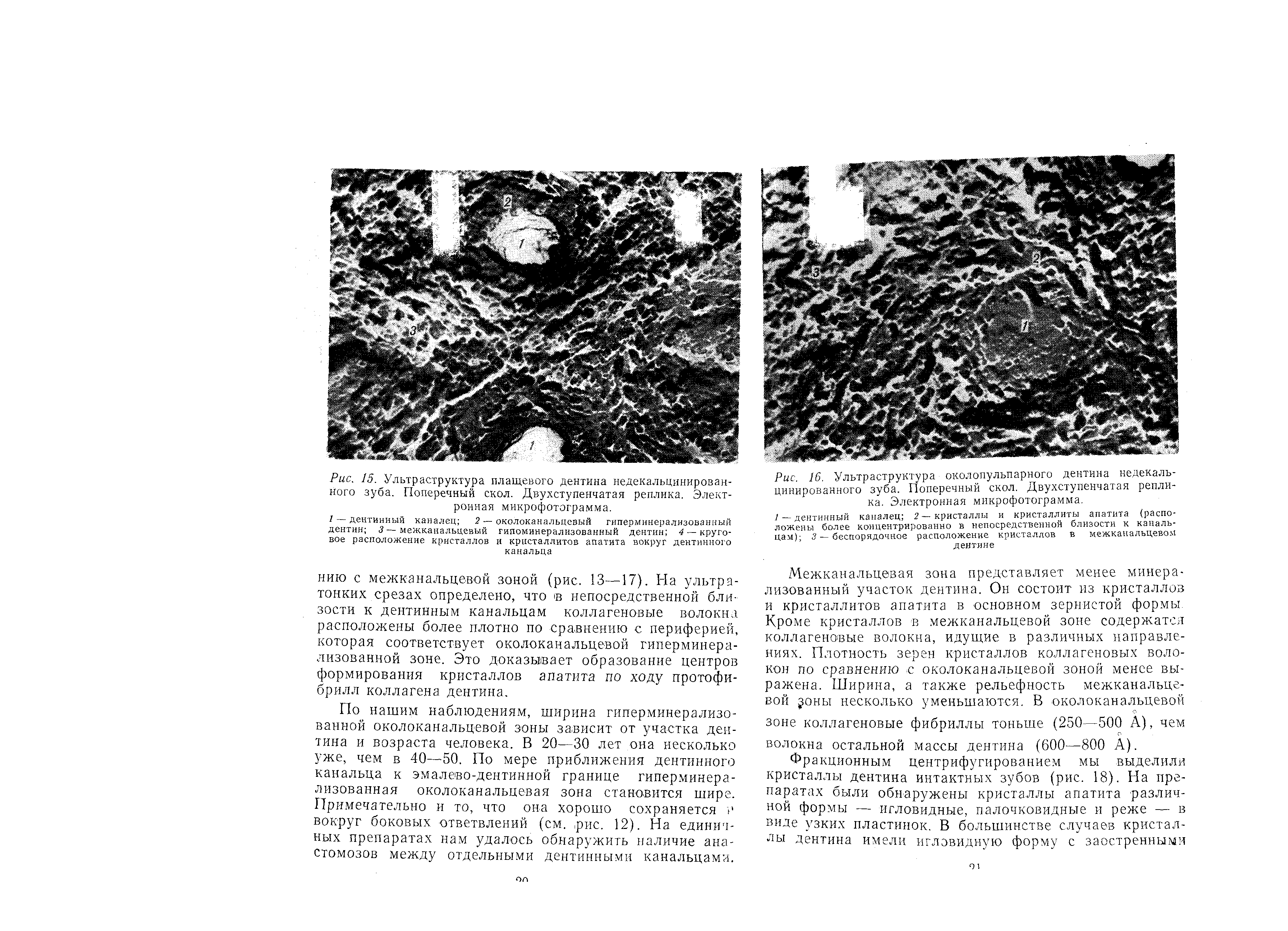 Рис. 15. Ультраструктура плащевого дентина недекальцинирован-ного зуба. Поперечный скол. Двухступенчатая реплика. Электронная микрофотограмма.