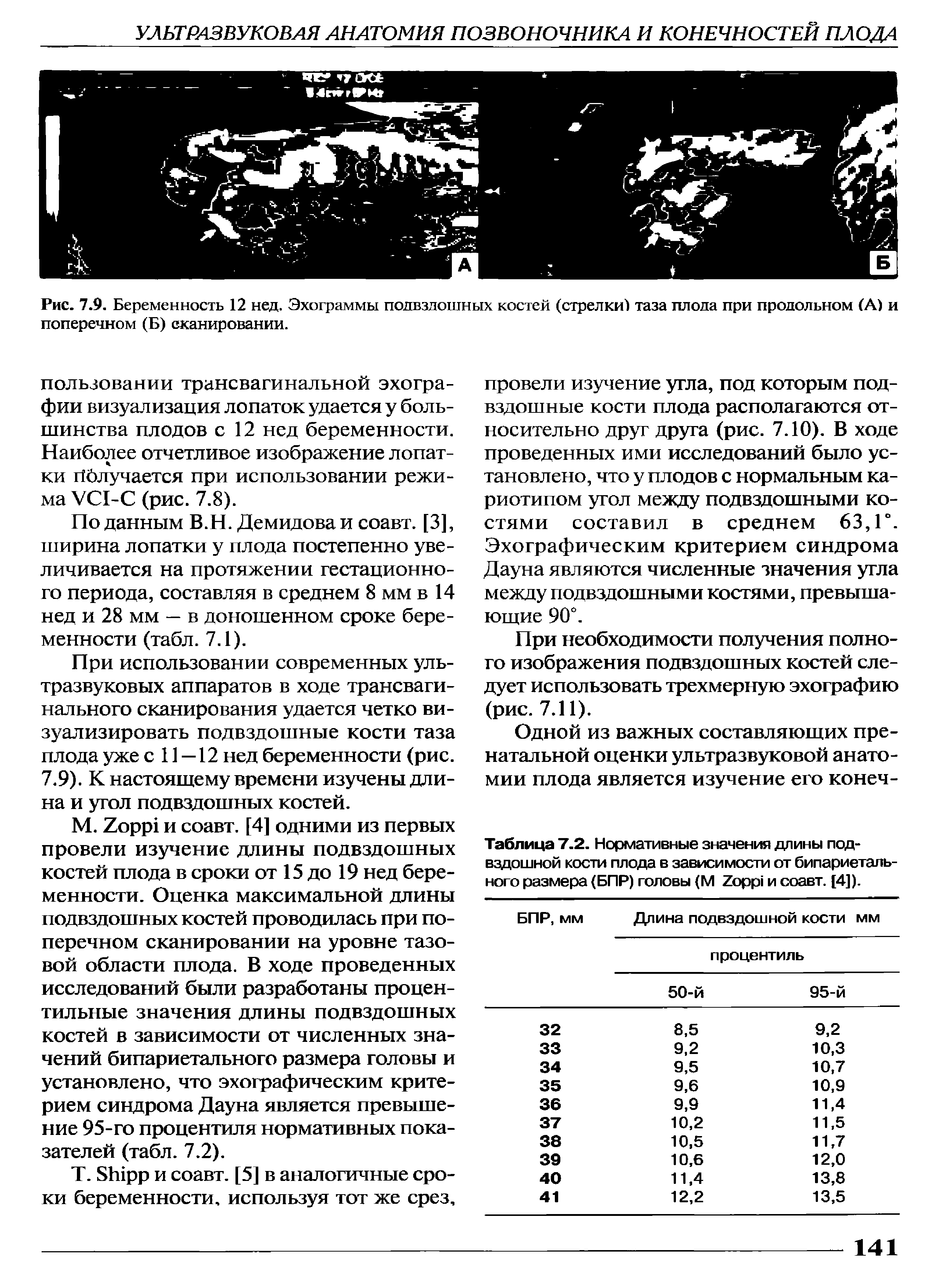 Таблица 7.2. Нормативные значения длины подвздошной кости плода в зависимости от бипариетального размера (БПР) головы (М Иорр и соавт. [4]).