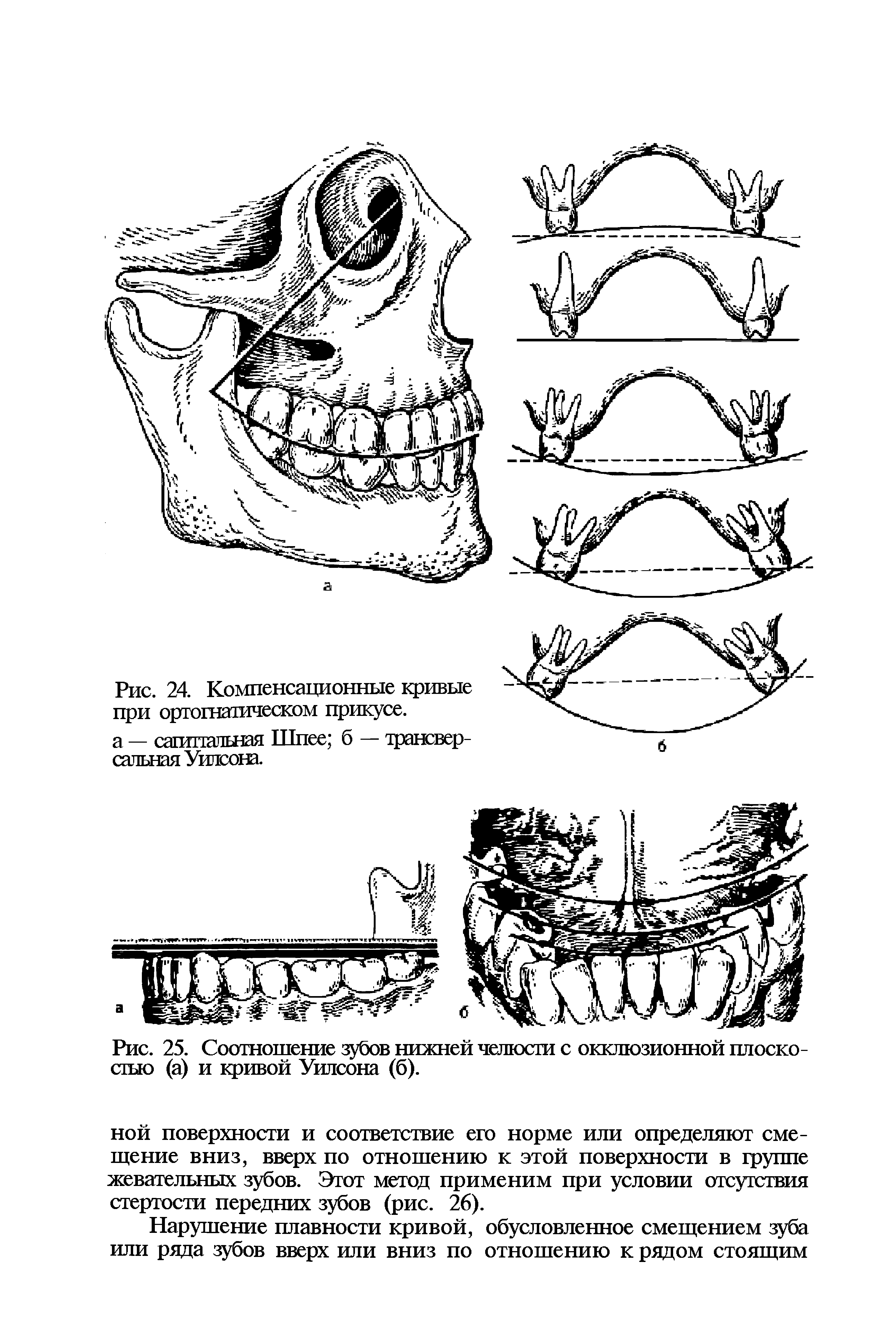 Рис. 25. Соотношение зубов нижней челюсти с окклюзионной плоскостью (а) и кривой Уилсона (б).