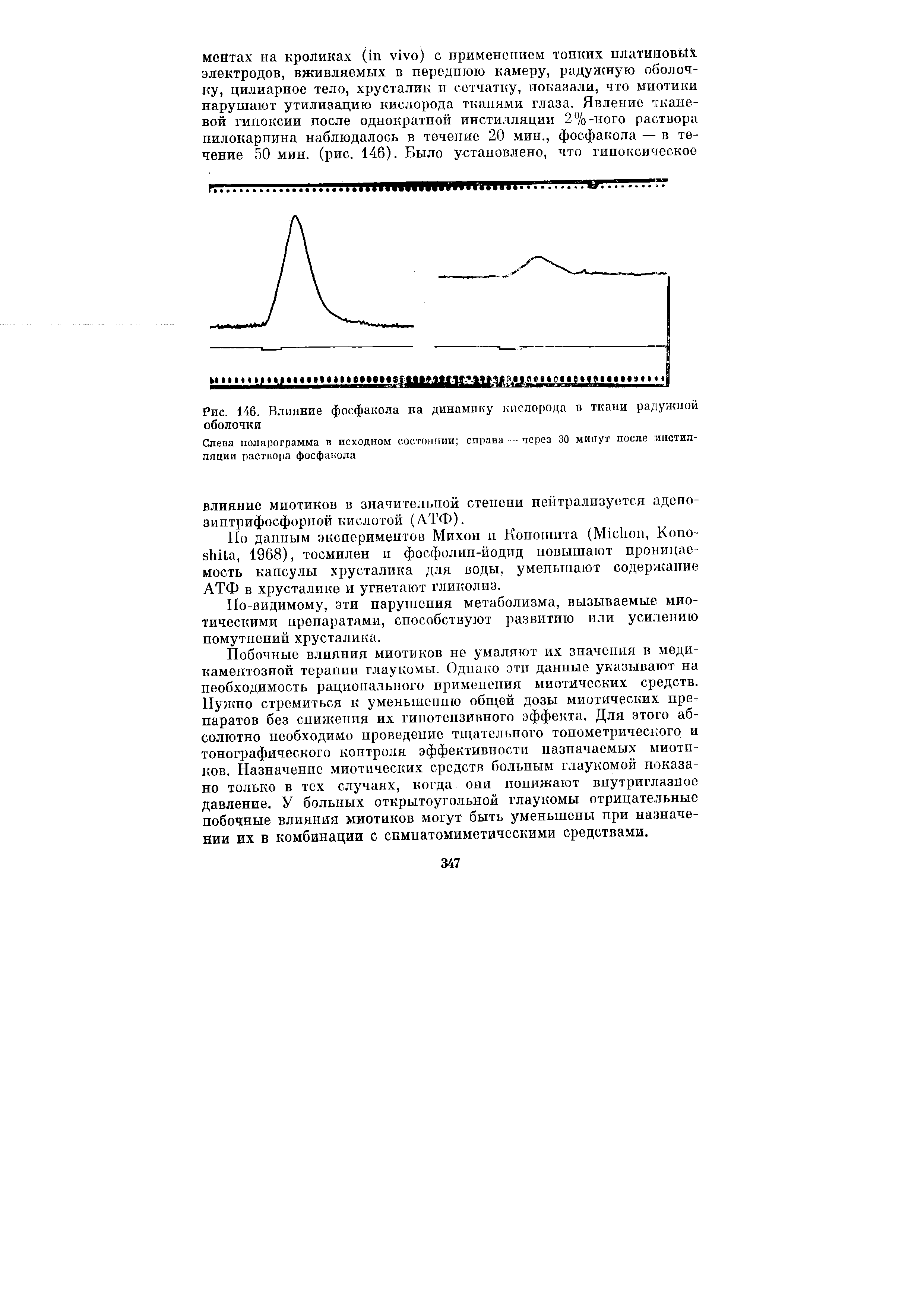 Рис. 146. Влияние фосфакола на динамику кислорода в ткани радужной оболочки...