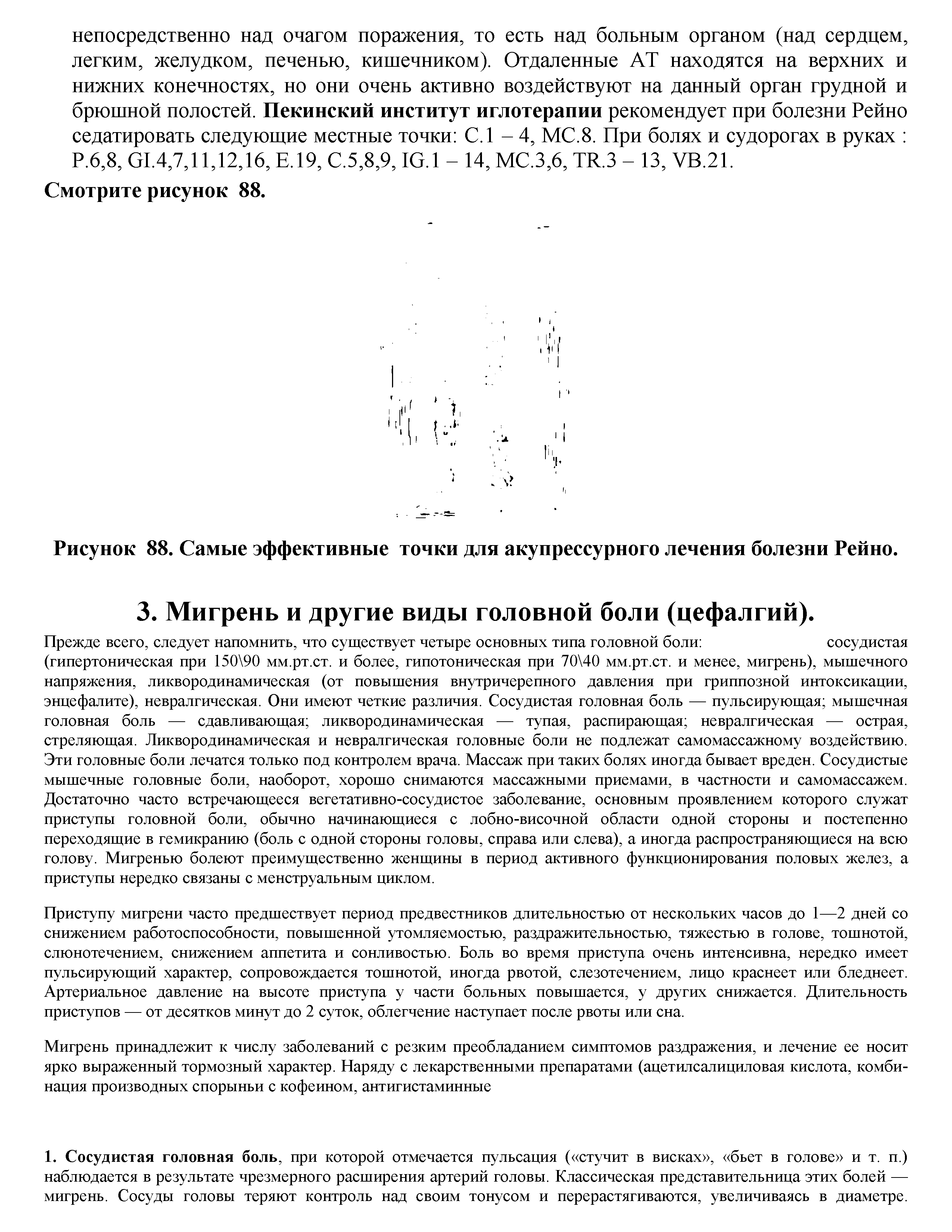 Рисунок 88. Самые эффективные точки для акупрессурного лечения болезни Рейно.