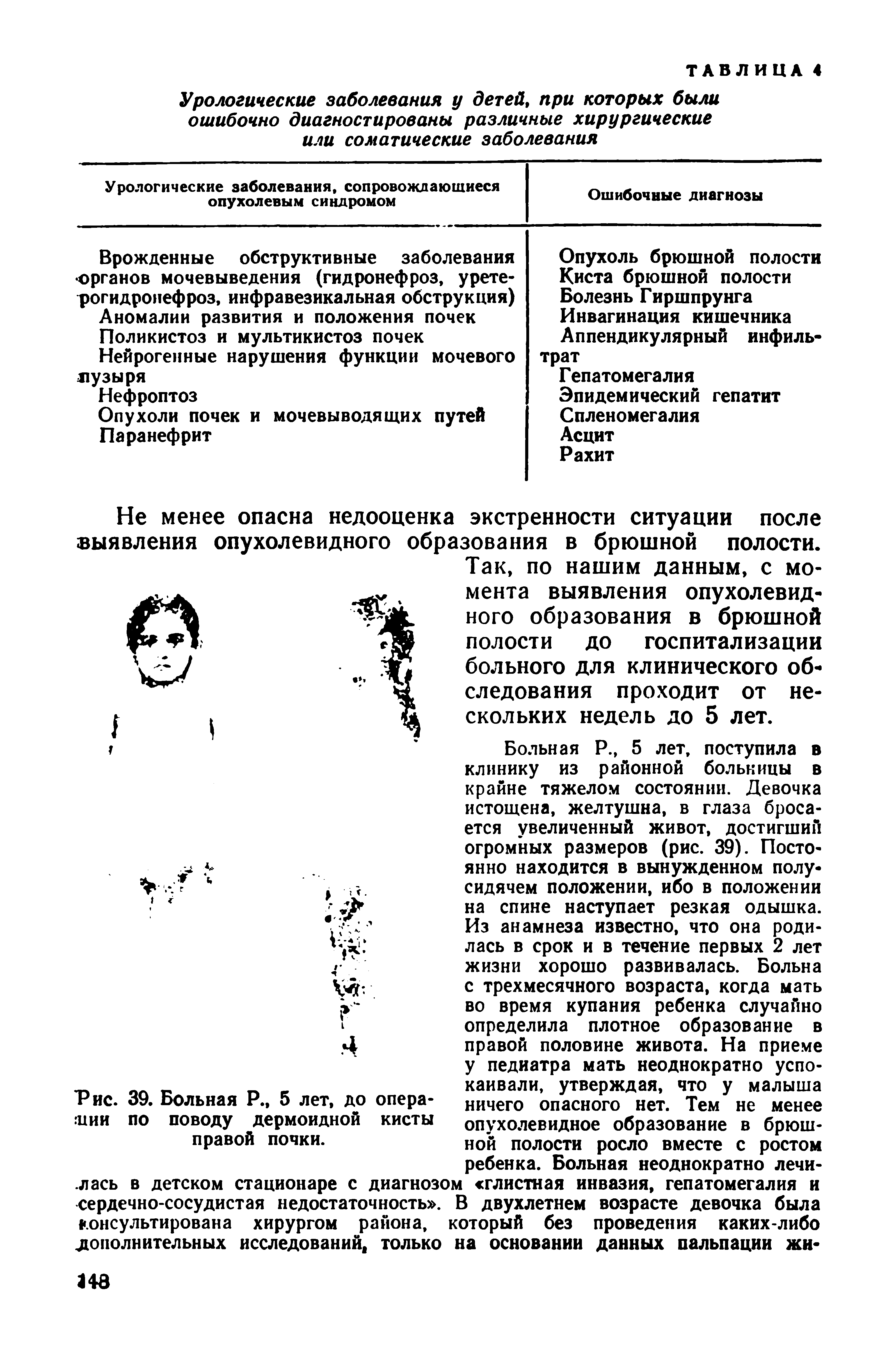 Рис. 39. Больная Р., 5 лет, до операции по поводу дермоидной кисты правой почки.