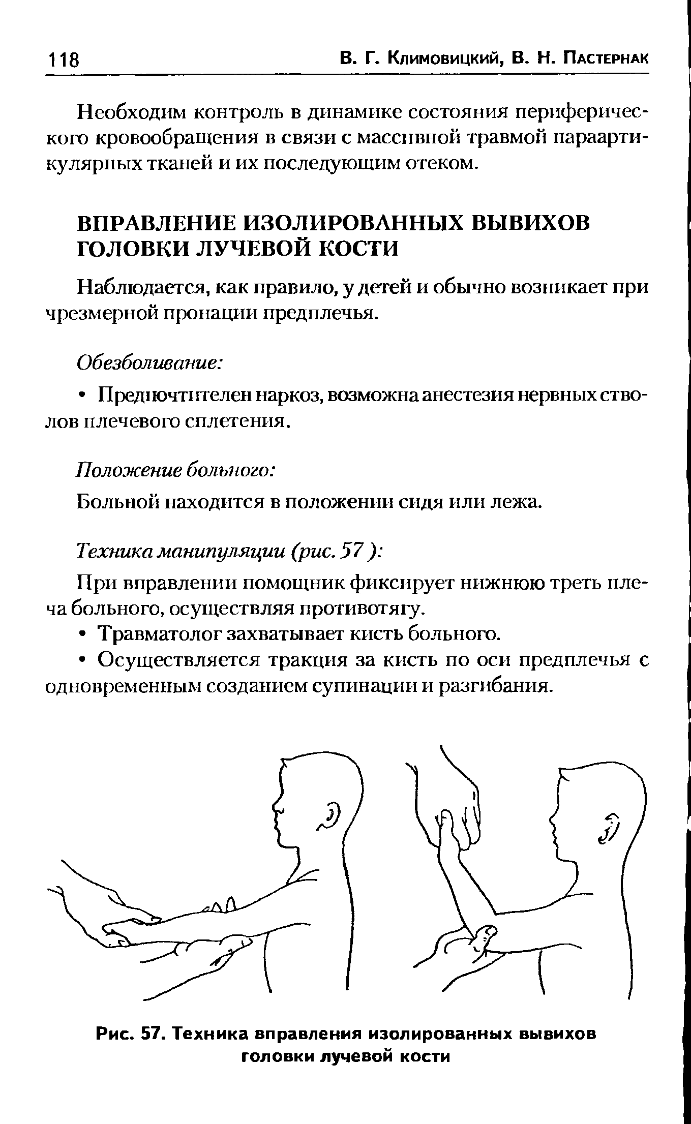 Рис. 57. Техника вправления изолированных вывихов головки лучевой кости...