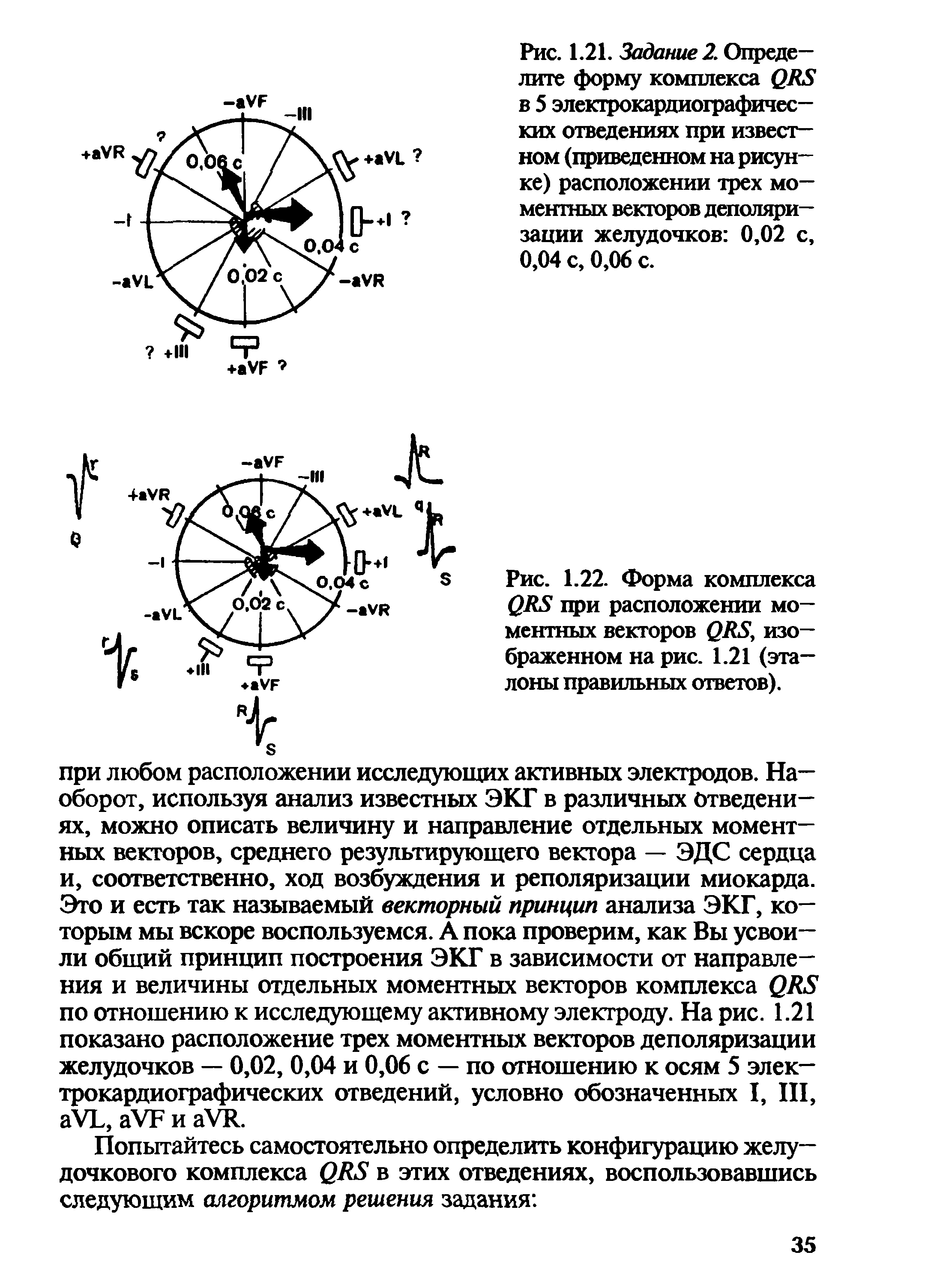 Рис. 1.22. Форма комплекса при расположении моментных векторов 0А5, изображенном на рис. 1.21 (эталоны правильных ответов).