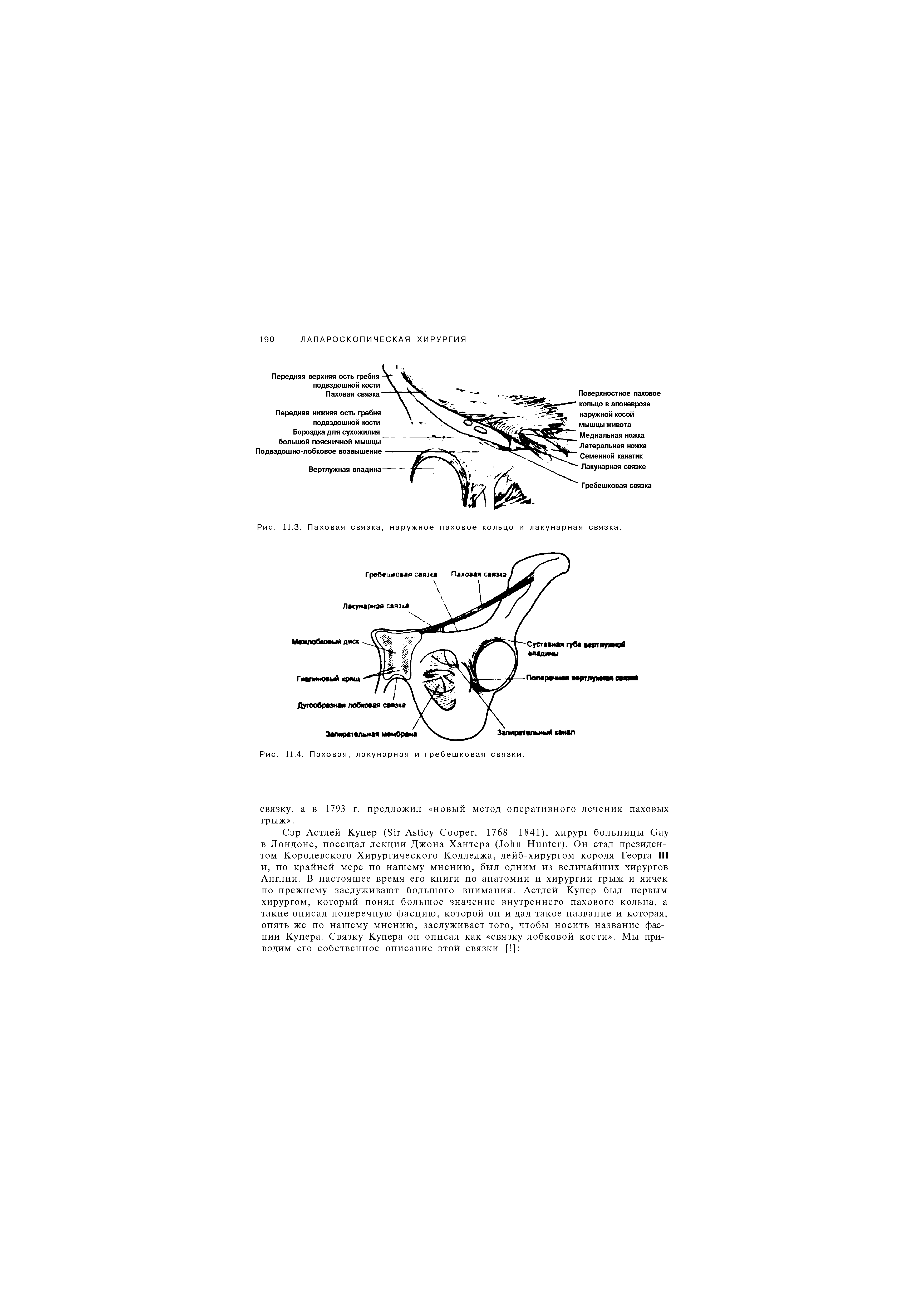 Рис. 11.3. Паховая связка, наружное паховое кольцо и лакунарная связка.