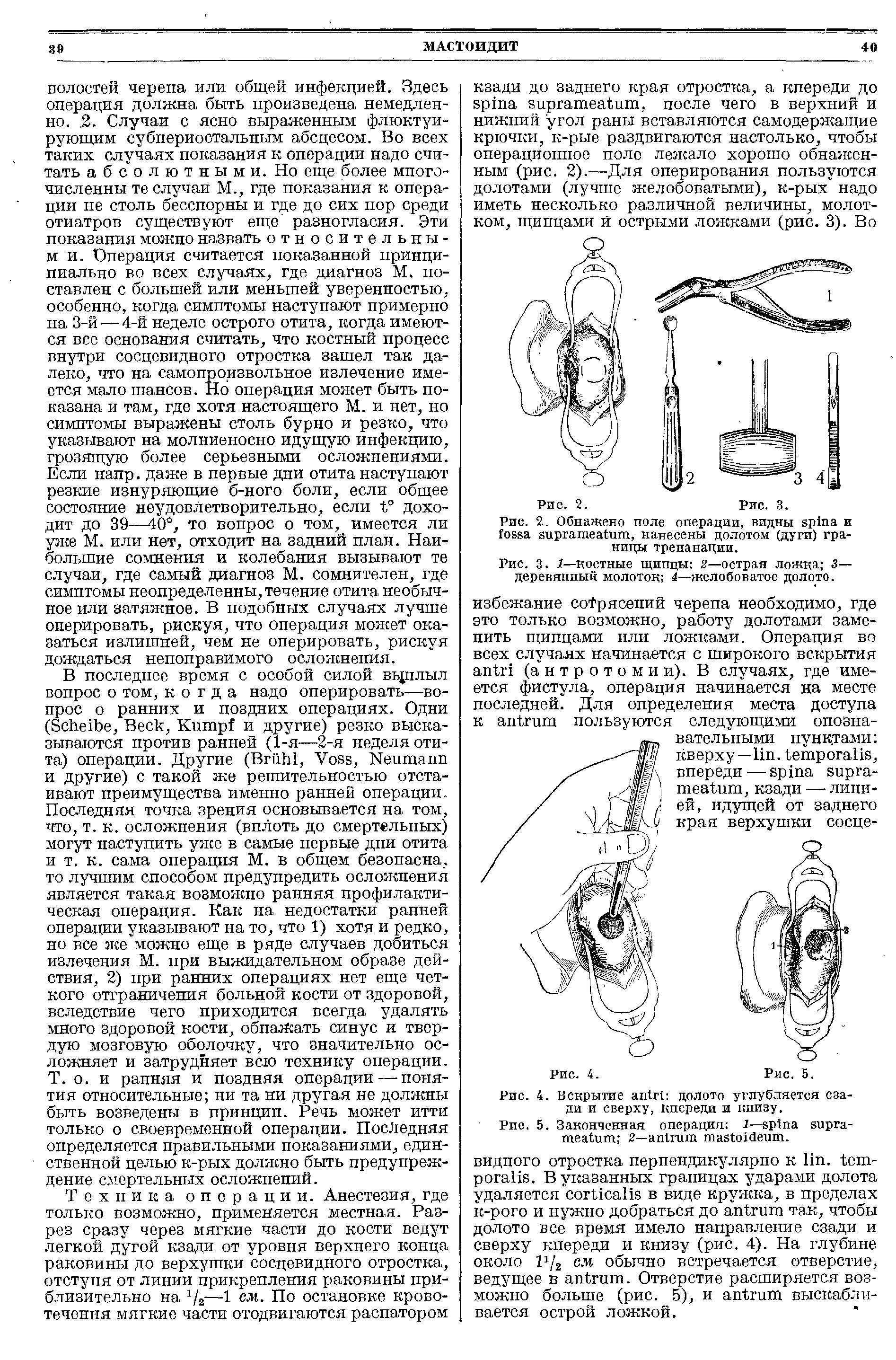 Рис. 5. Законченная операция г— 2— .