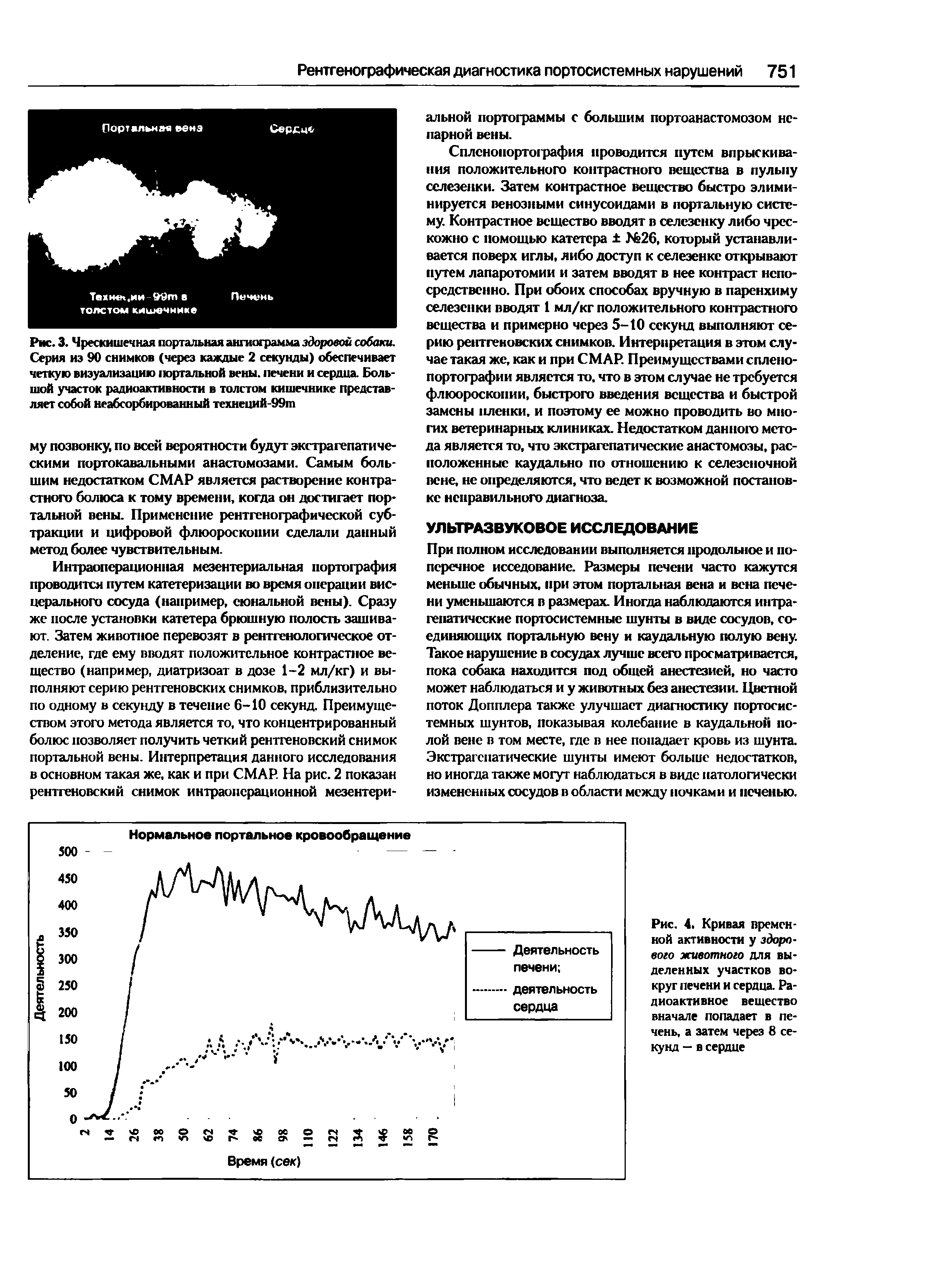 Рис. 3. Чрескишечная портальная ангиограмма здоровой собаки. Серия из 90 снимков (через каждые 2 секунды) обеспечивает четкую визуализацию портальной вены, печени и сердца. Большой участок радиоактивности в толстом кишечнике представляет собой неабсорбированный технеций-99ш...