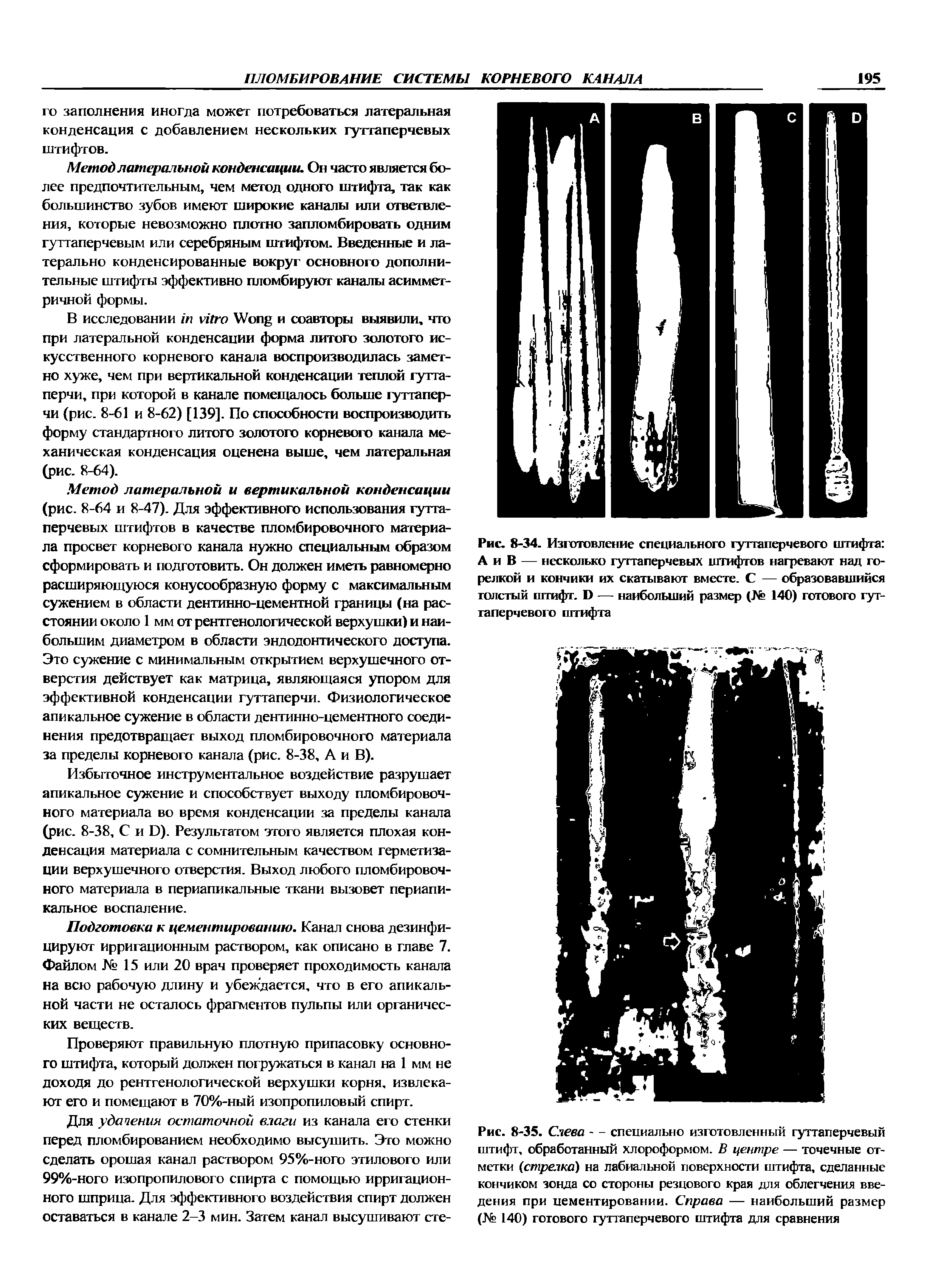 Рис. 8-35. Слева — специально изготовленный гуттаперчевый штифт, обработанный хлороформом. В центре — точечные отметки (стрелка) на лабиальной поверхности штифта, сделанные кончиком зонда со стороны резцового края для облегчения введения при цементировании. Справа — наибольший размер (Ке 140) готового гуттаперчевого штифта для сравнения...