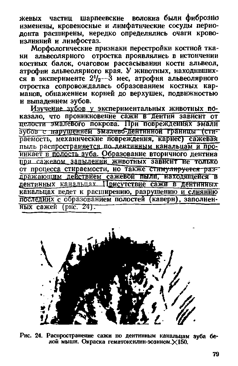 Рис. 24. Распространение сажи по дентинным канальцам зуба белой мыши. Окраска гематоксилин-зозином.><150.