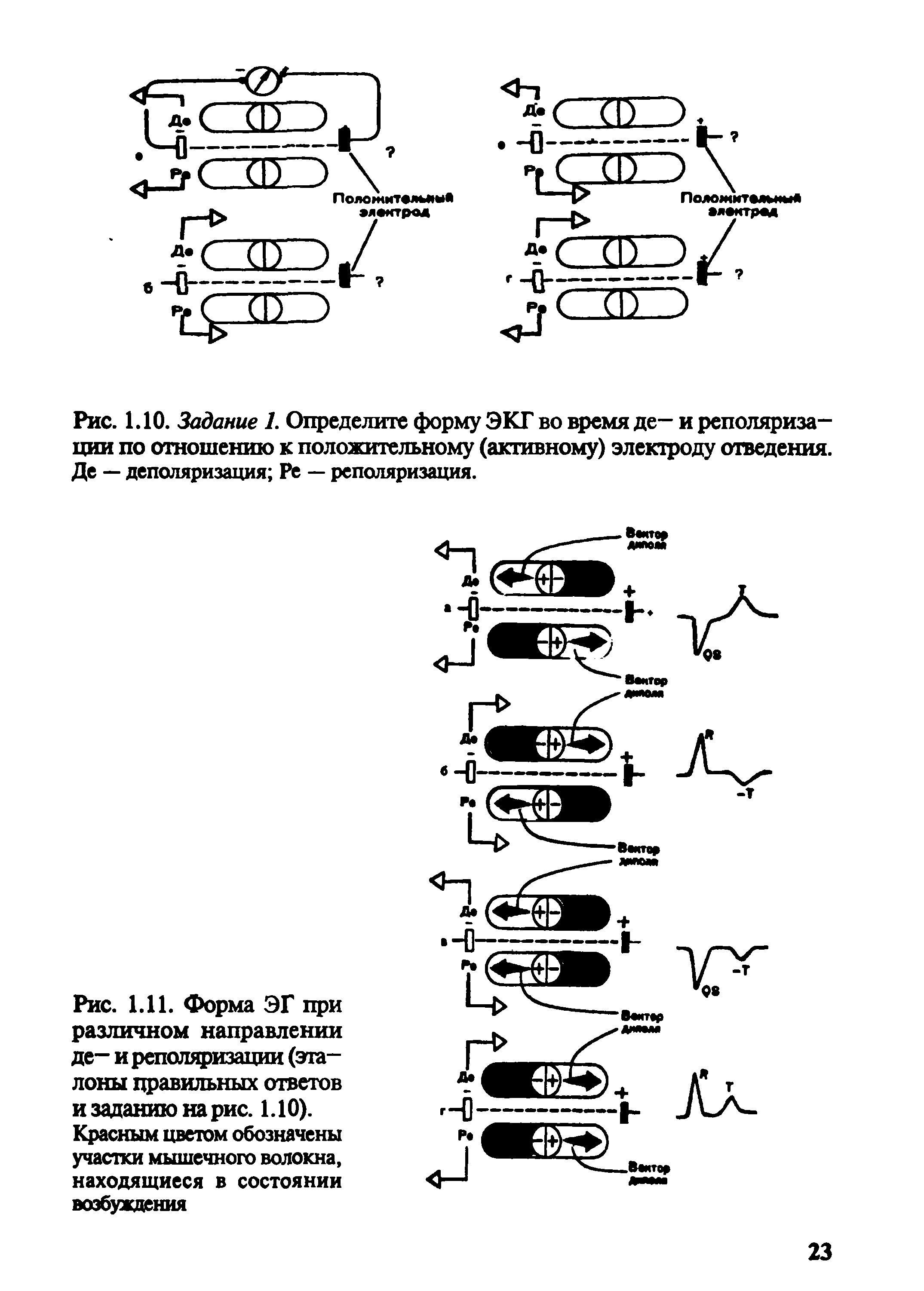 Рис. 1.11. Форма ЭГ при различном направлении де- и реполяризации (эталоны правильных ответов и заданию на рис. 1.10). Красным цветом обозначены участки мышечного волокна, находящиеся в состоянии возбуждения...