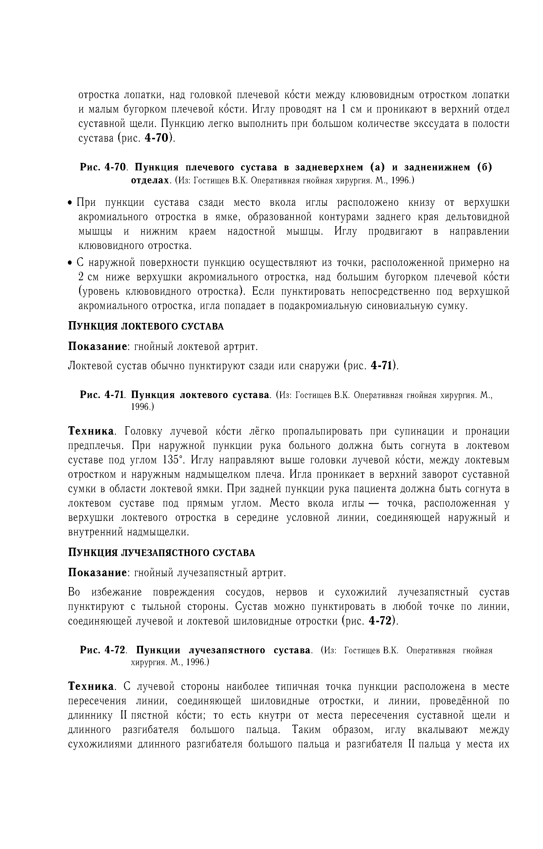 Рис. 4-71. Пункция локтевого сустава. (Из Гостищев В.К. Оперативная гнойная хирургия. М., 1996.)...