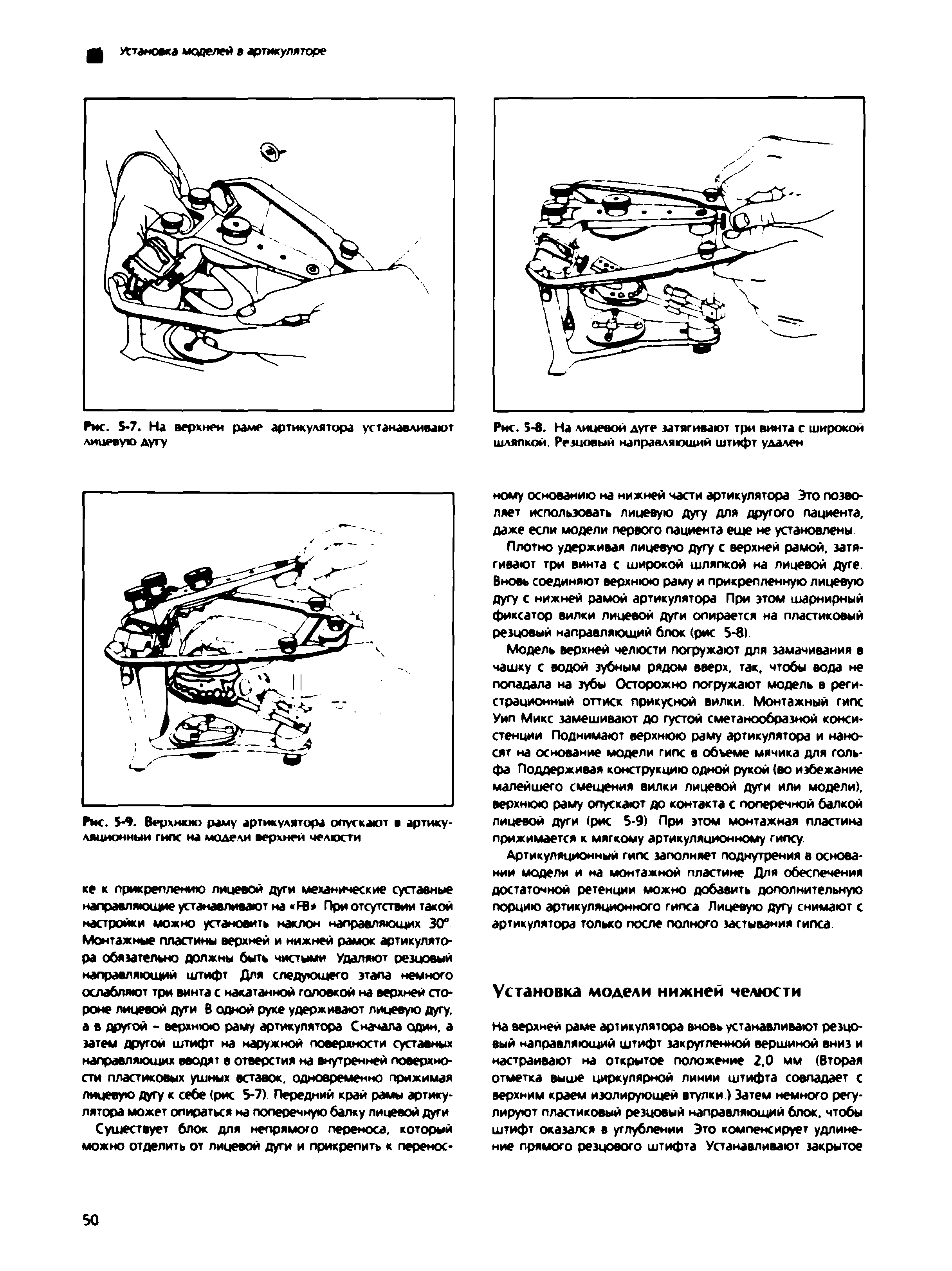 Рис. 5-9. Верхнюю раму артикулятора опускают в артикуляционный гипс на модели верхней челюсти...