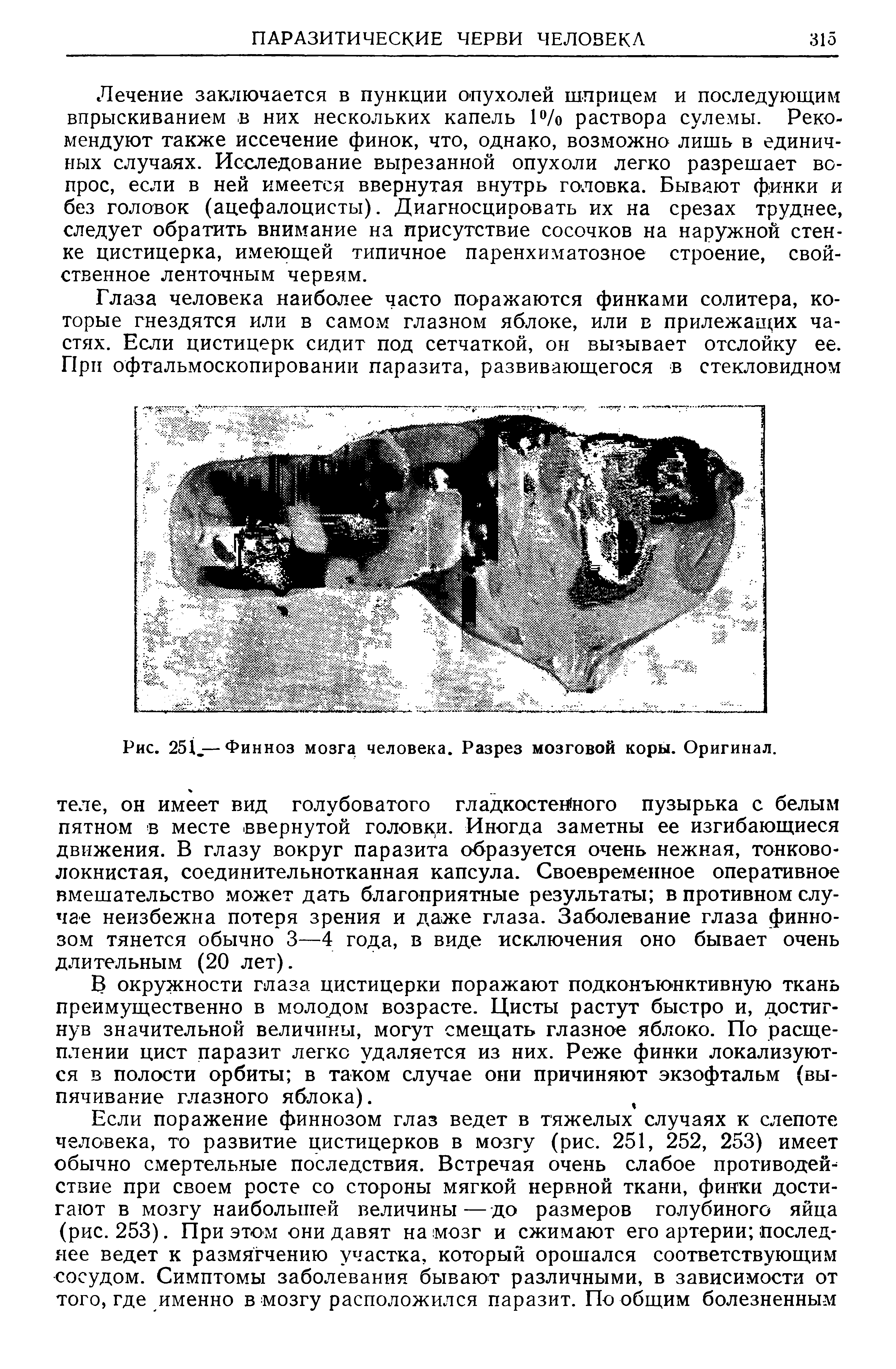 Рис. 251.— Финноз мозга человека. Разрез мозговой коры. Оригинал.