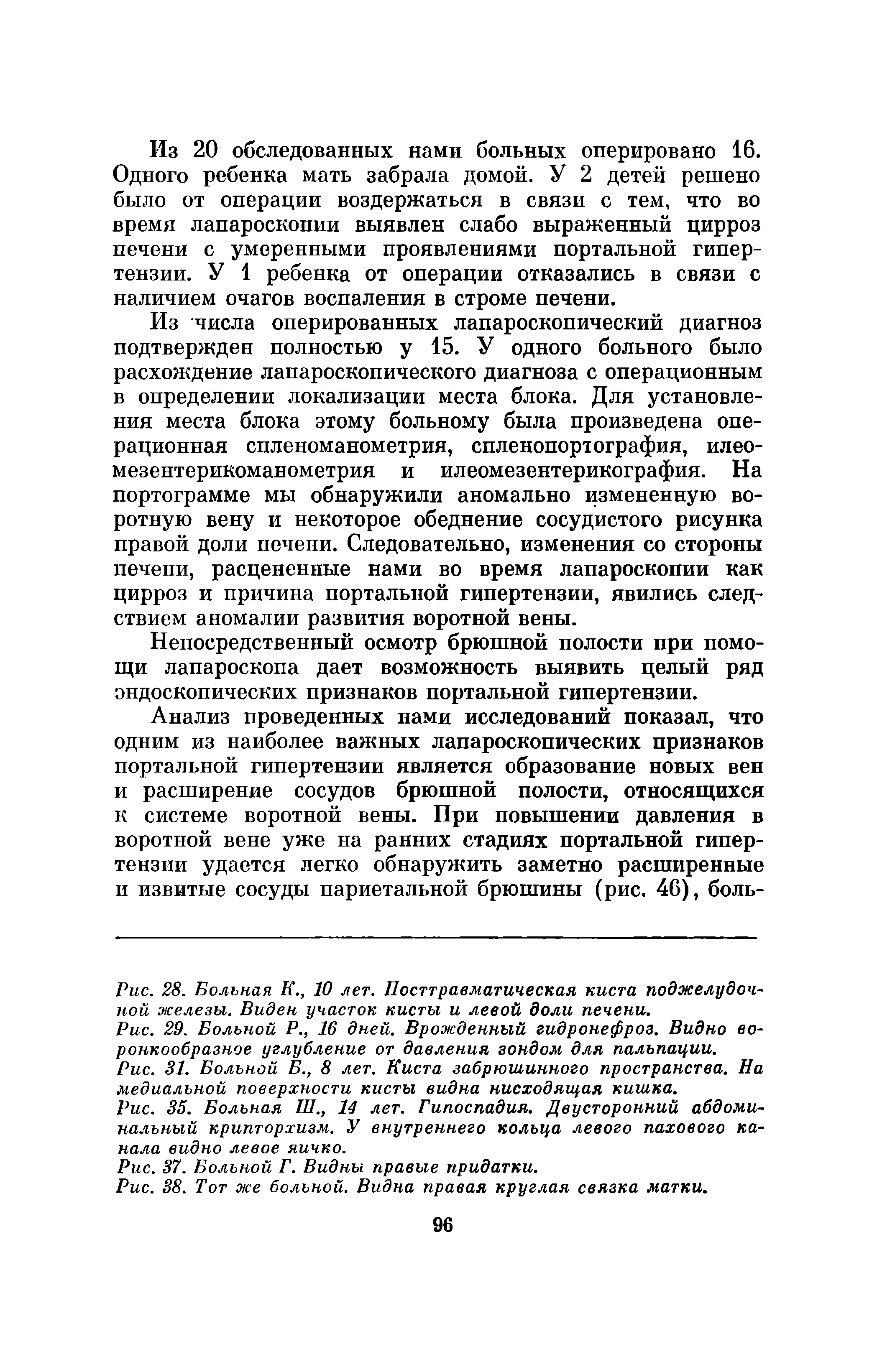 Рис. 28. Больная К., 10 лет. Посттравматическая киста поджелудочной железы. Виден участок кисты и левой доли печени.