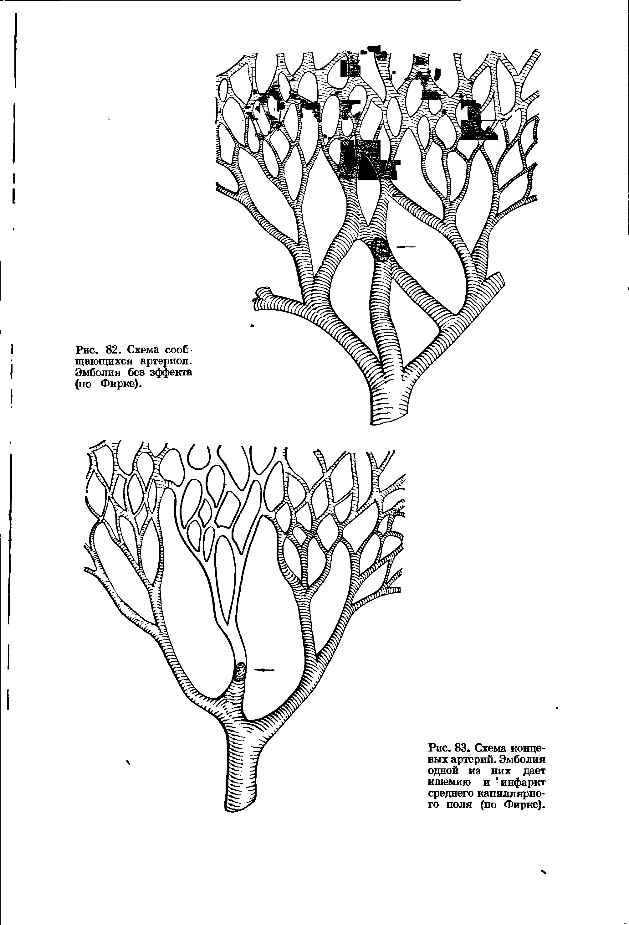 Рис. 83. Схема концевых артерий. Эмболия одной из них дает ишемию и инфаркт среднего капиллярного поля (по Фирке).