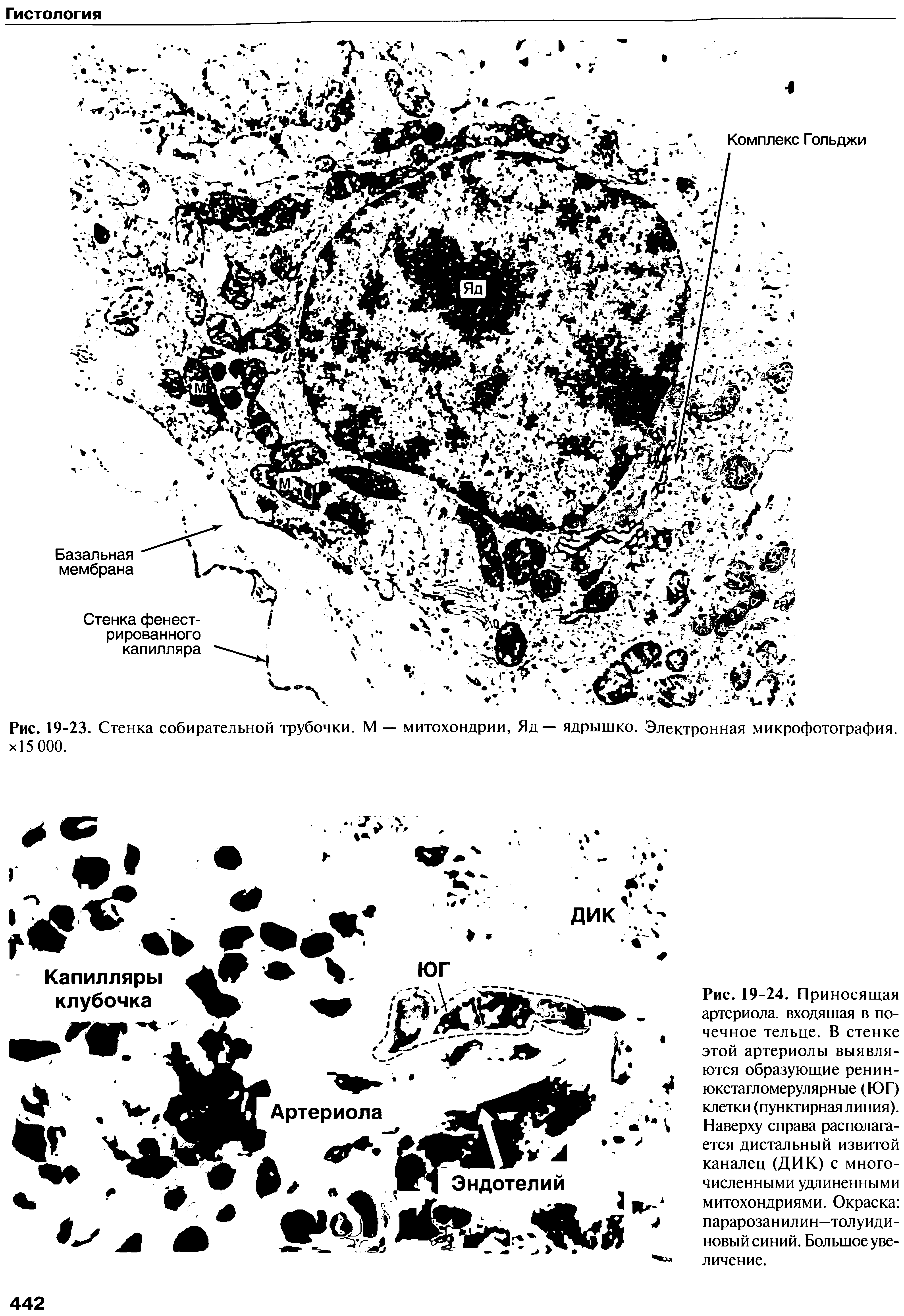 Рис. 19-24. Приносящая артериола, входящая в почечное тельце. В стенке этой артериолы выявляются образующие ренин-юкстагломерулярные (ЮГ) клетки (пунктирная линия). Наверху справа располагается дистальный извитой каналец (ДИК) с многочисленными удлиненными митохондриями. Окраска парарозанилин—толуидиновый синий. Большое увеличение.