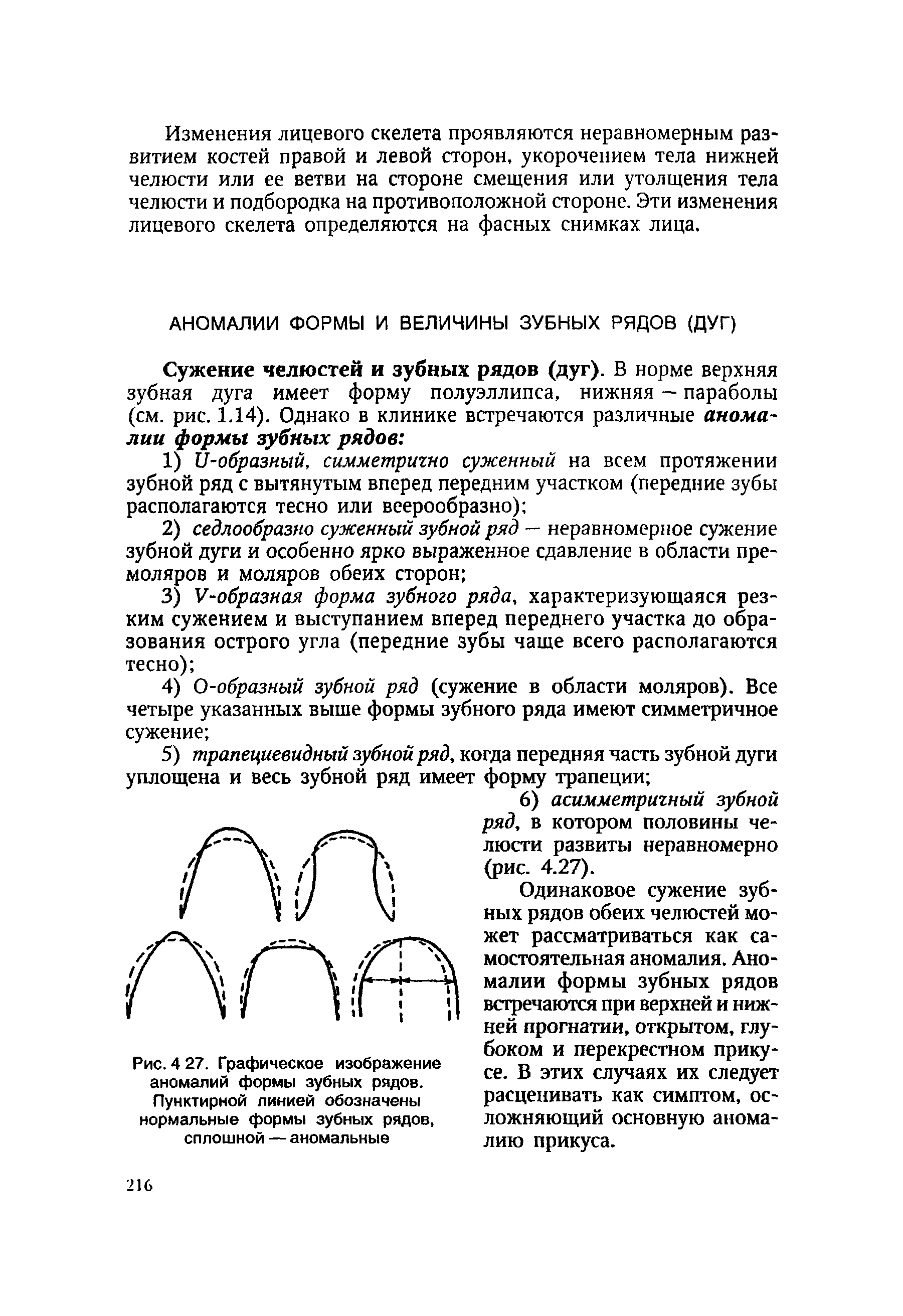 Рис. 4 27. Графическое изображение аномалий формы зубных рядов. Пунктирной линией обозначены нормальные формы зубных рядов, сплошной — аномальные...