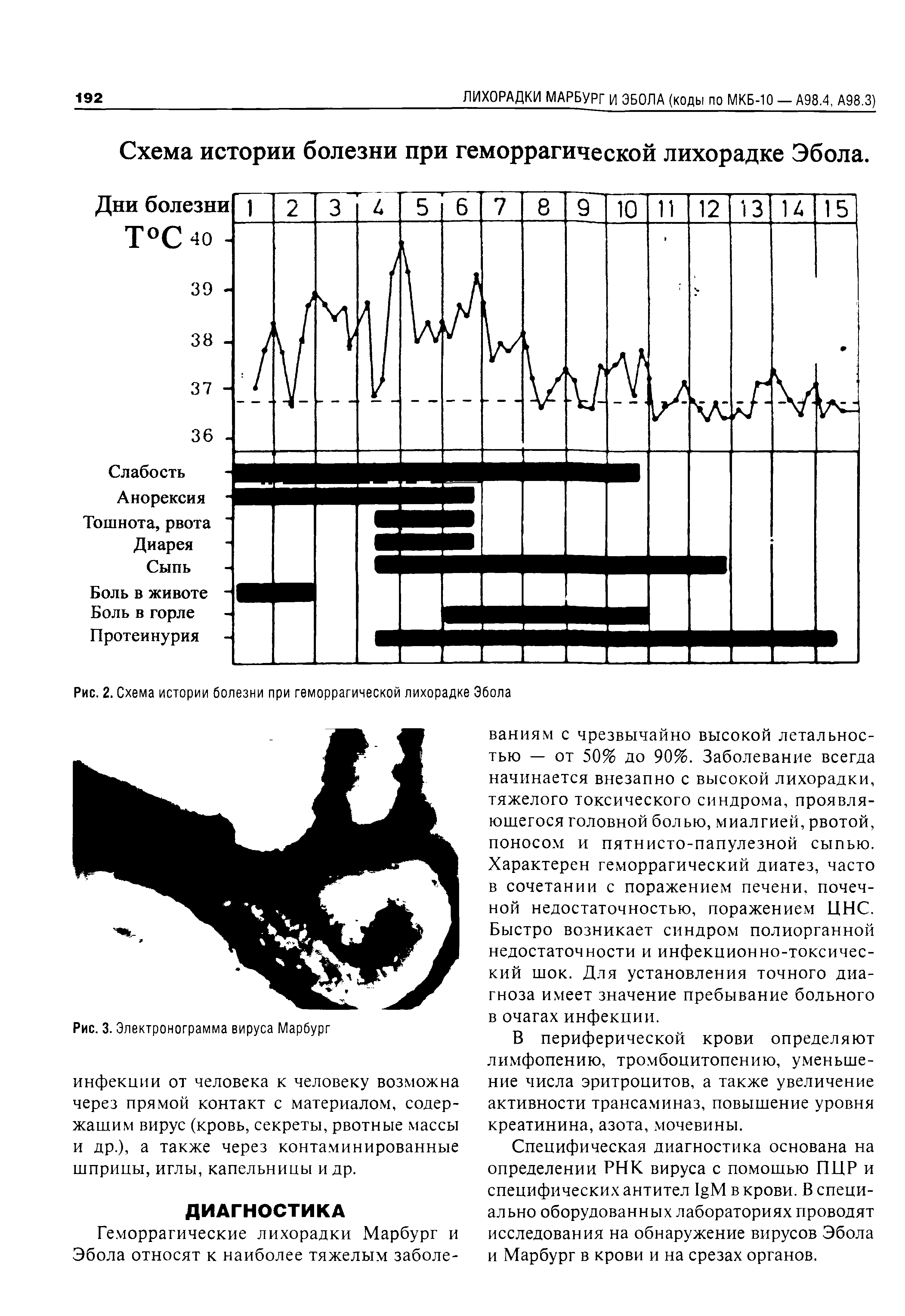 Рис. 2. Схема истории болезни при геморрагической лихорадке Эбола...