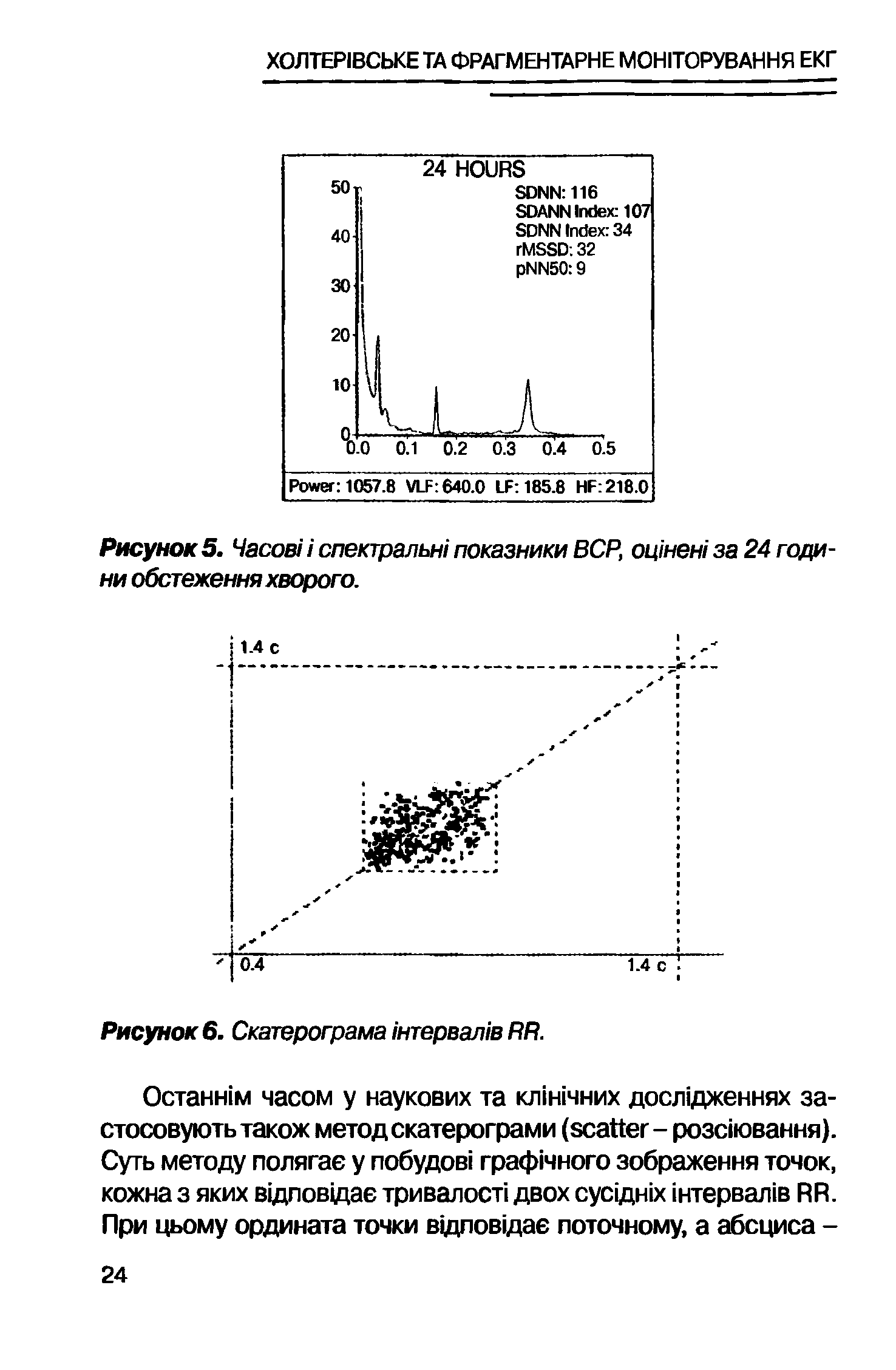 Рисунок 5. Часов спектральн/ показники BCP, оценен/ за 24 годи-ни обстеження хворого.