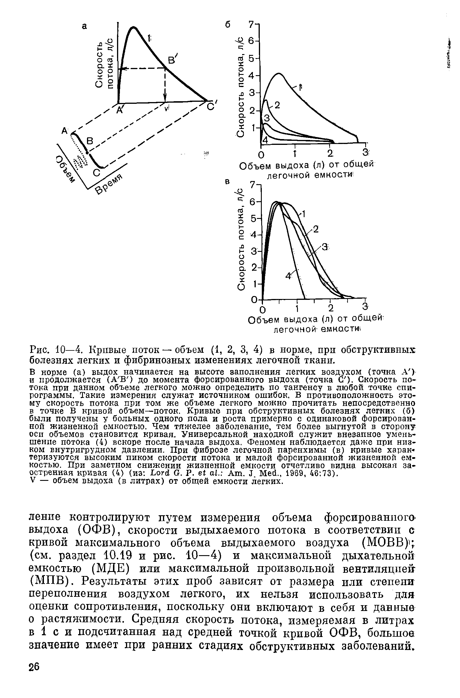 Рис. 10—4. Кривые поток —объем (1, 2, 3, 4) в норме, при обструктивных болезнях легких и фибринозных изменениях легочной ткани.