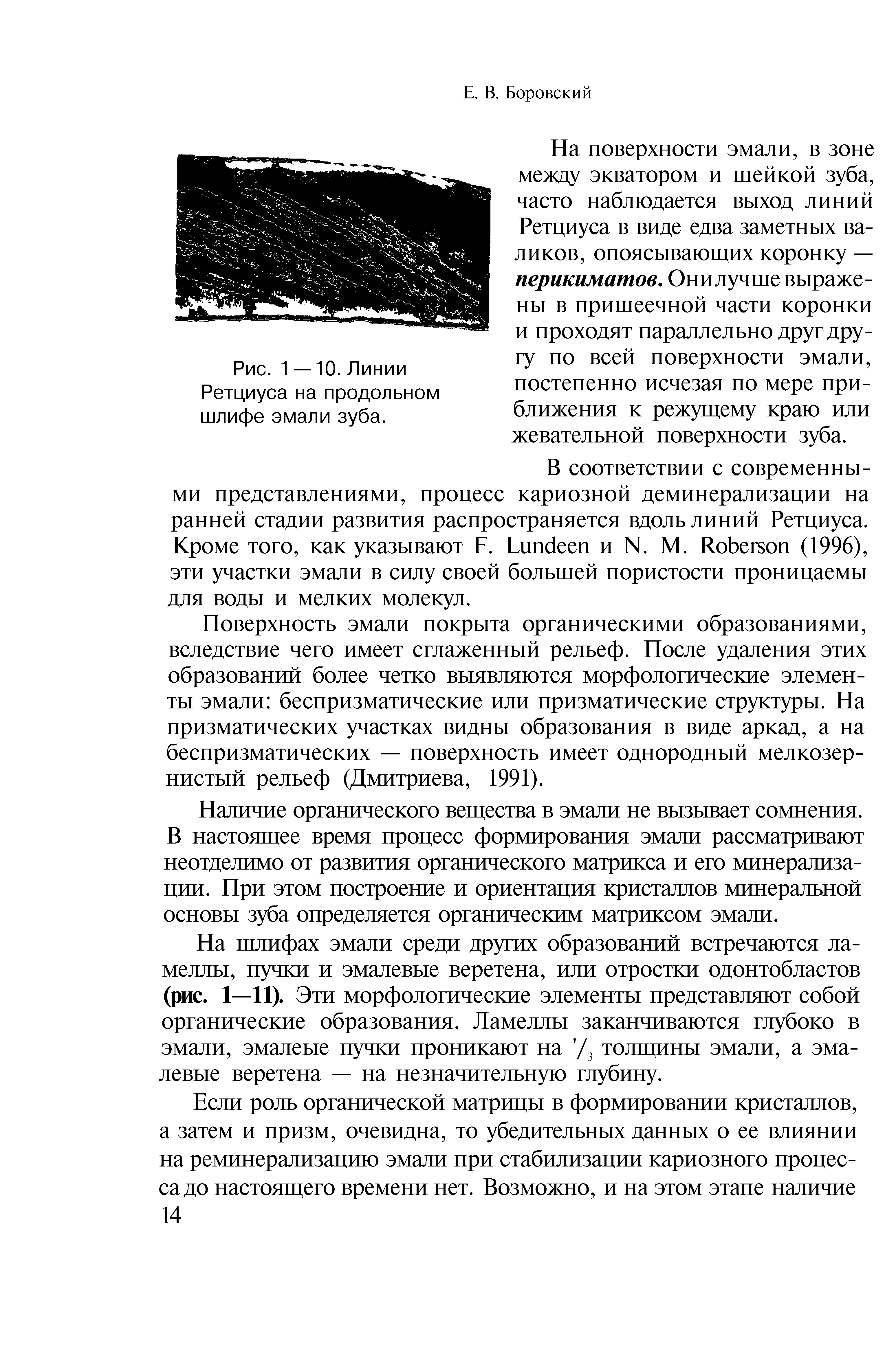 Рис. 1 —10. Линии Ретциуса на продольном шлифе эмали зуба.