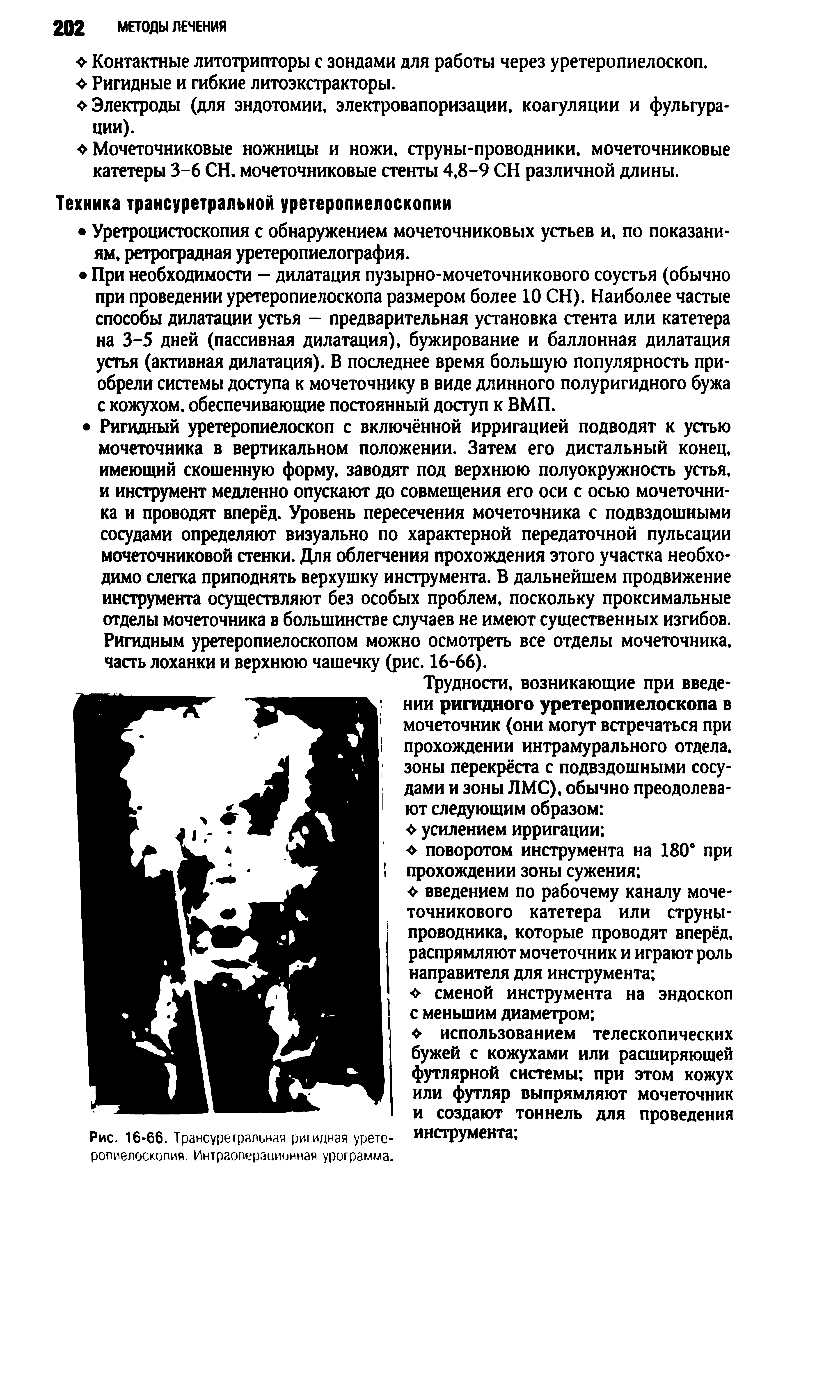 Рис. 16-66. Трансуретральная ригидная урете-ропиелоскопия. Интраоперационная урограмма.