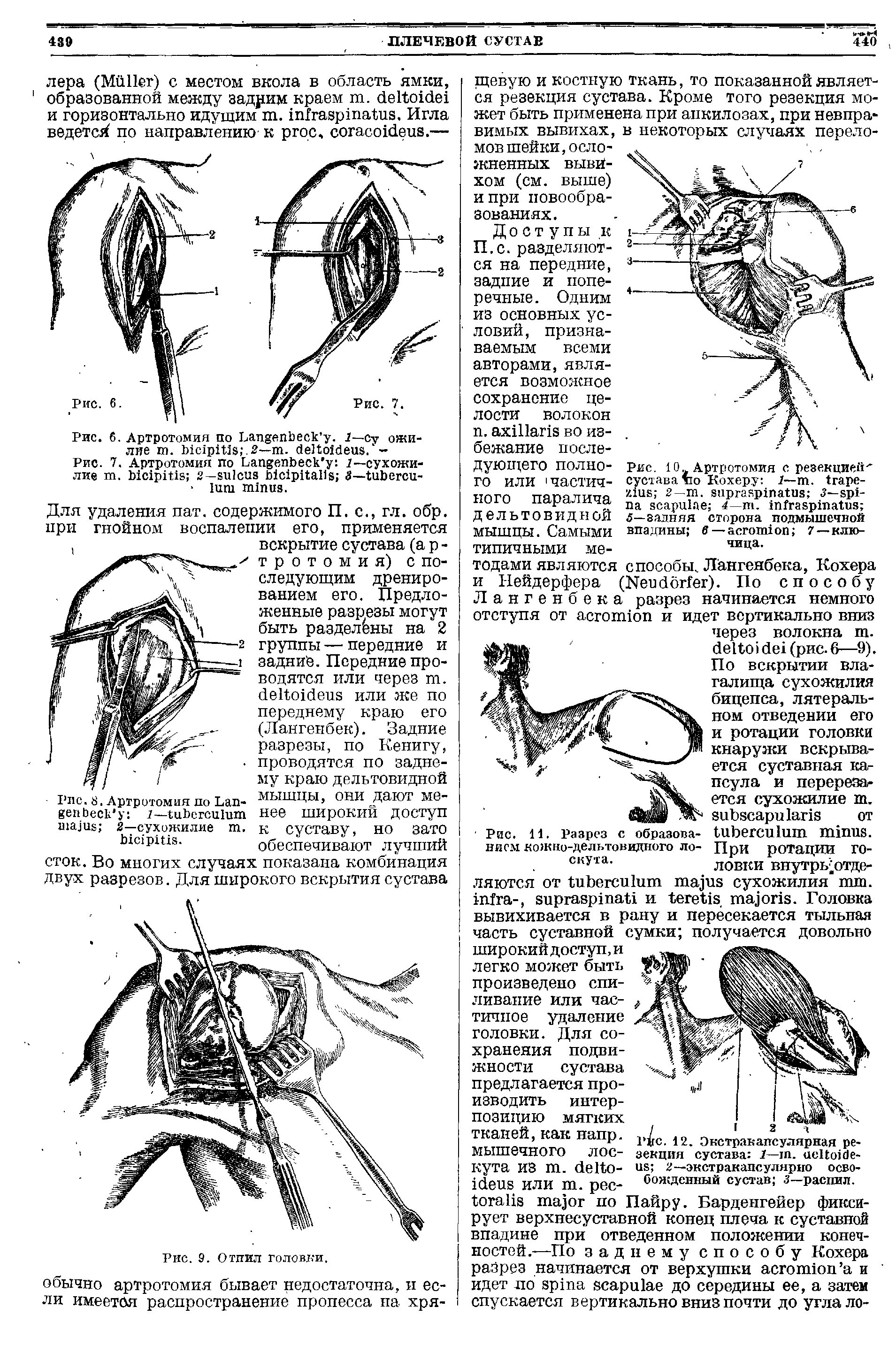 Рис. 7. Артротомия по L 1— сухожилие . 2— — - I .