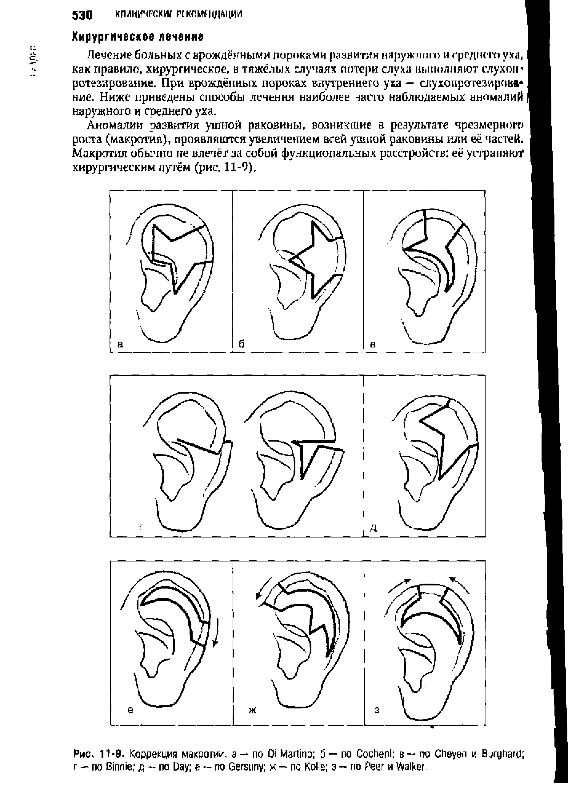 Рис. 11 -9. Коррекция макрогии. а — по D M б — по C в — по C и B г — по B д — по D е — по G ж — по K з — по P и W .