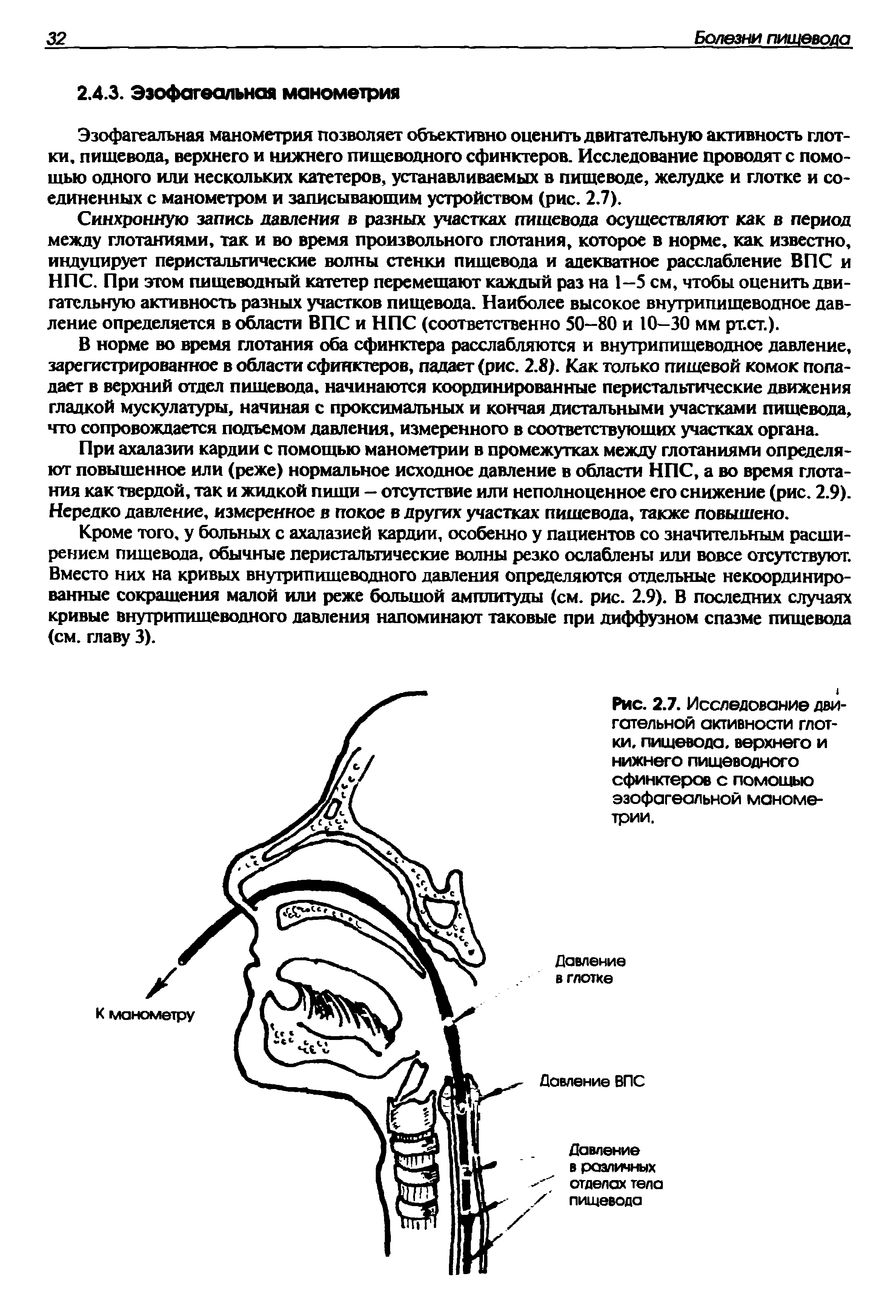 Рис. 2.7. Исследование двигательной активности глотки, пищевода, верхнего и нижнего пищеводного сфинктеров с помощью эзофагеальной манометрии.