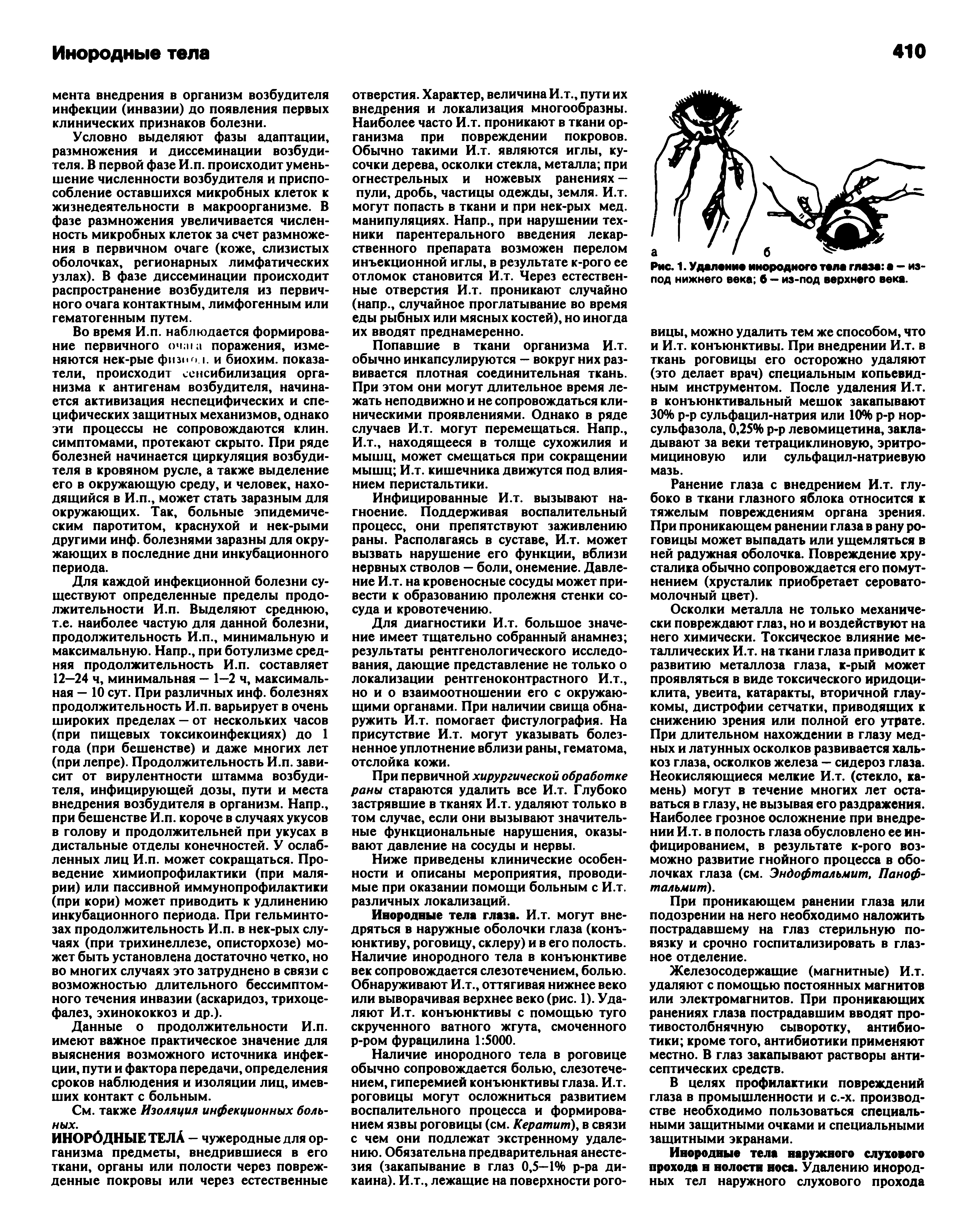 Рис. 1. Удаление инородного тела глаза а — из под нижнего века б — из-под верхнего века.