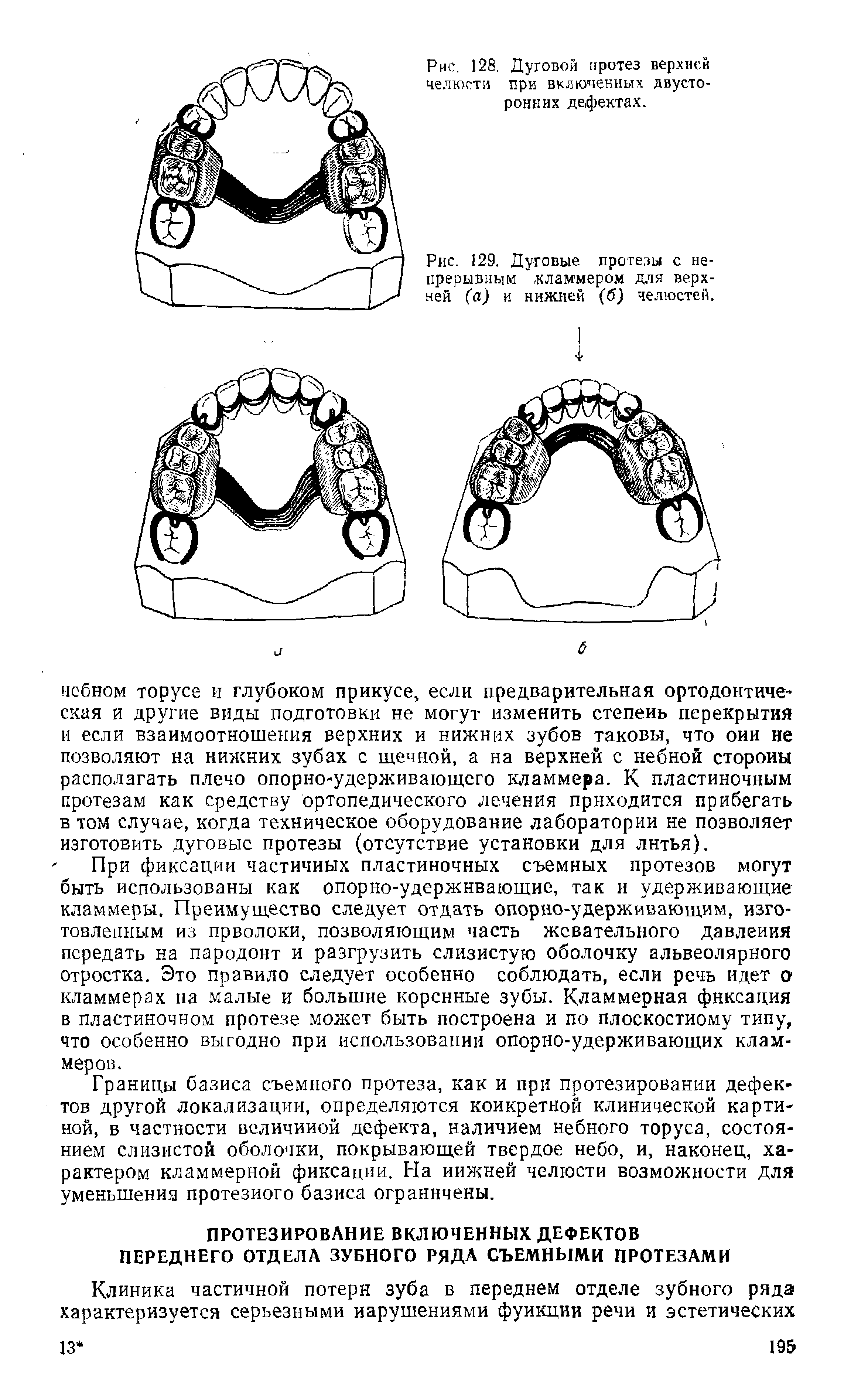 Рис. 129. Дуговые протезы с непрерывным кламмером для верхней (а) и нижней (б) челюстей.