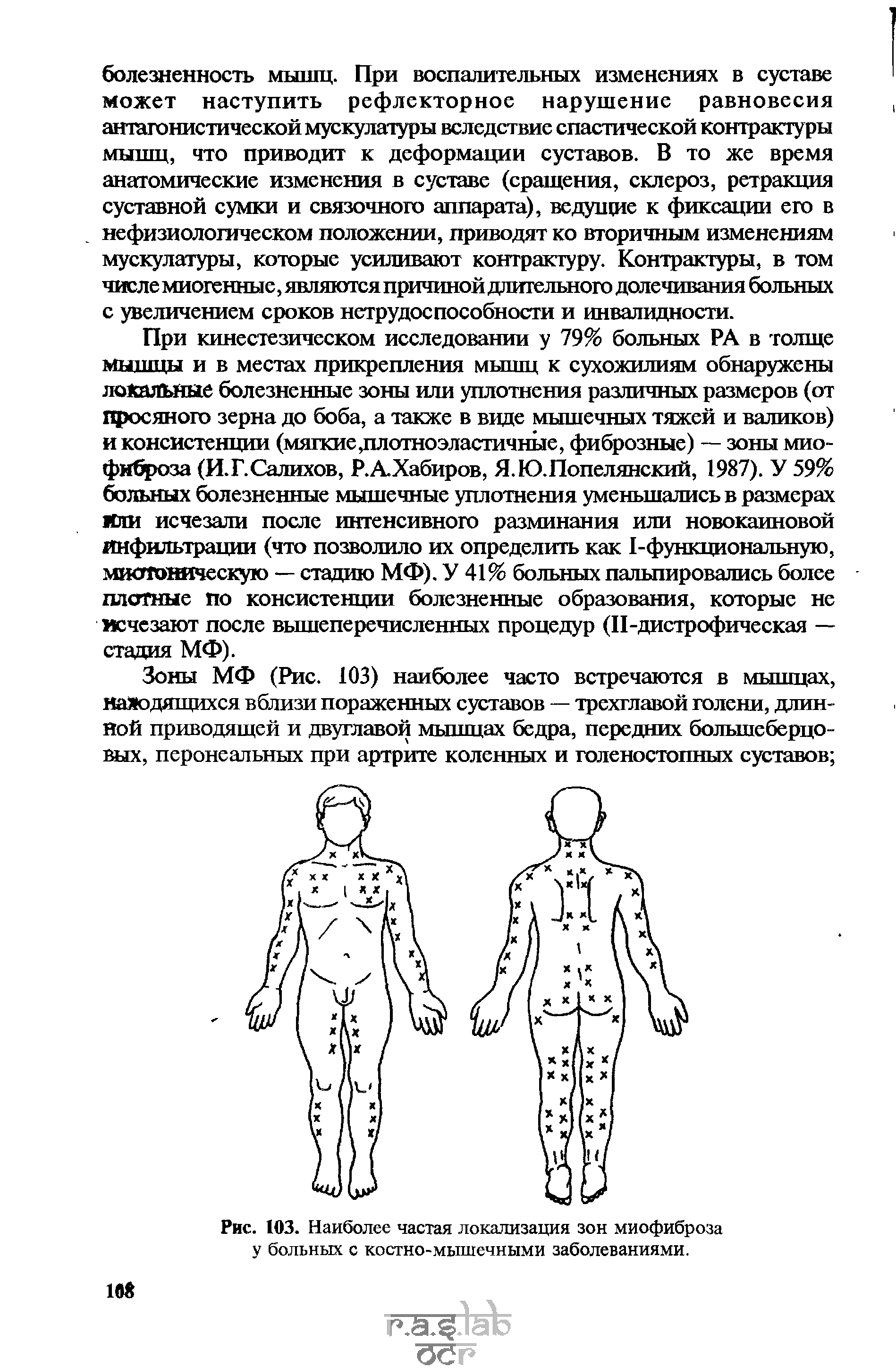 Рис. 103. Наиболее частая локализация зон миофиброза у больных с костно-мышечными заболеваниями.