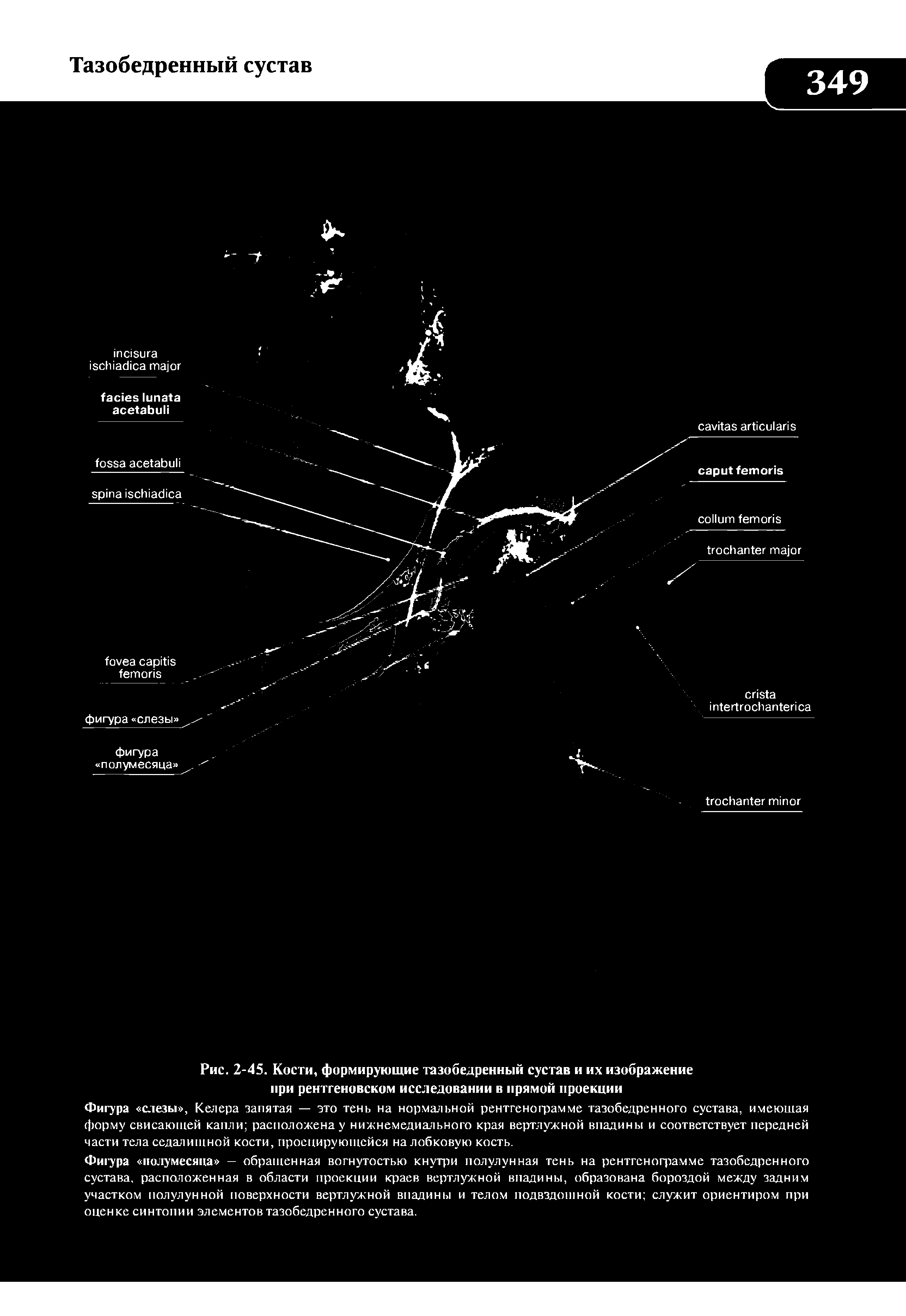 Рис. 2-45. Кости, формирующие тазобедренный сустав и их изображение при рентгеновском исследовании в прямой проекции...