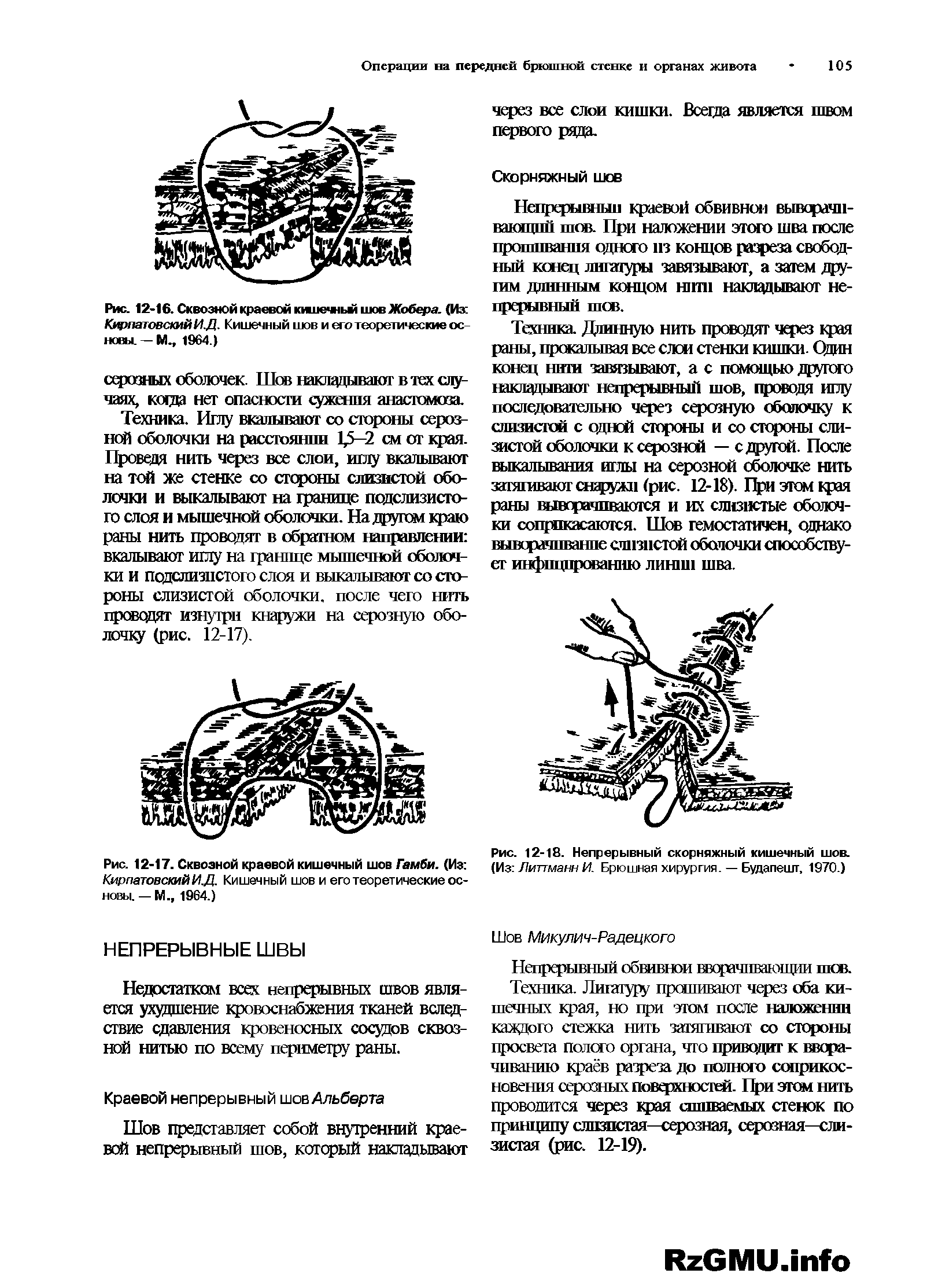 Рис. 12-17. Сквозной краевой кишечный шов Гамби. (Из КирпатовскийИ.Д. Кишечный шов и его теоретические основы. — М., 1964.)...