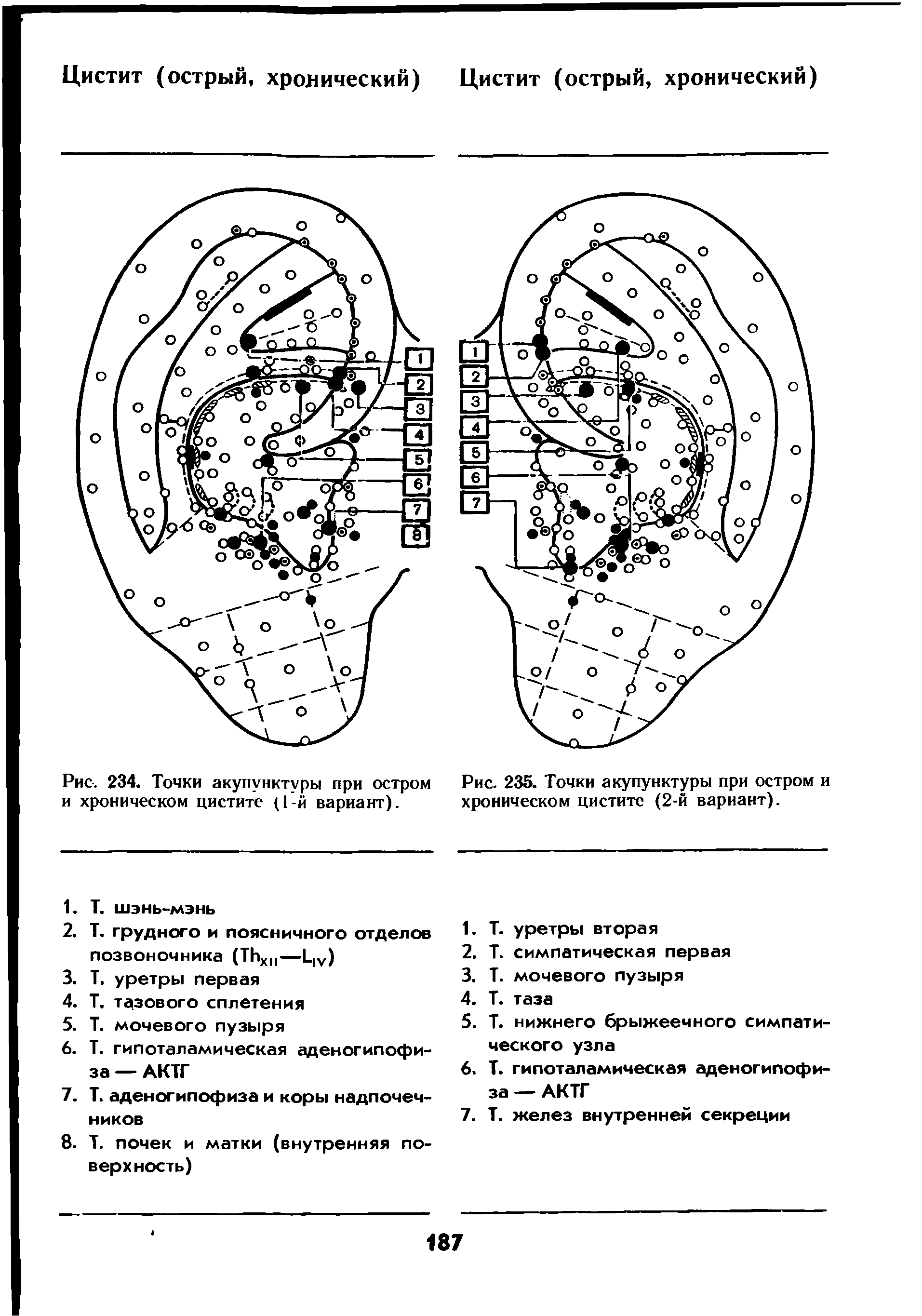 Рис. 234. Точки акупунктуры при остром и хроническом цистите (1-й вариант).