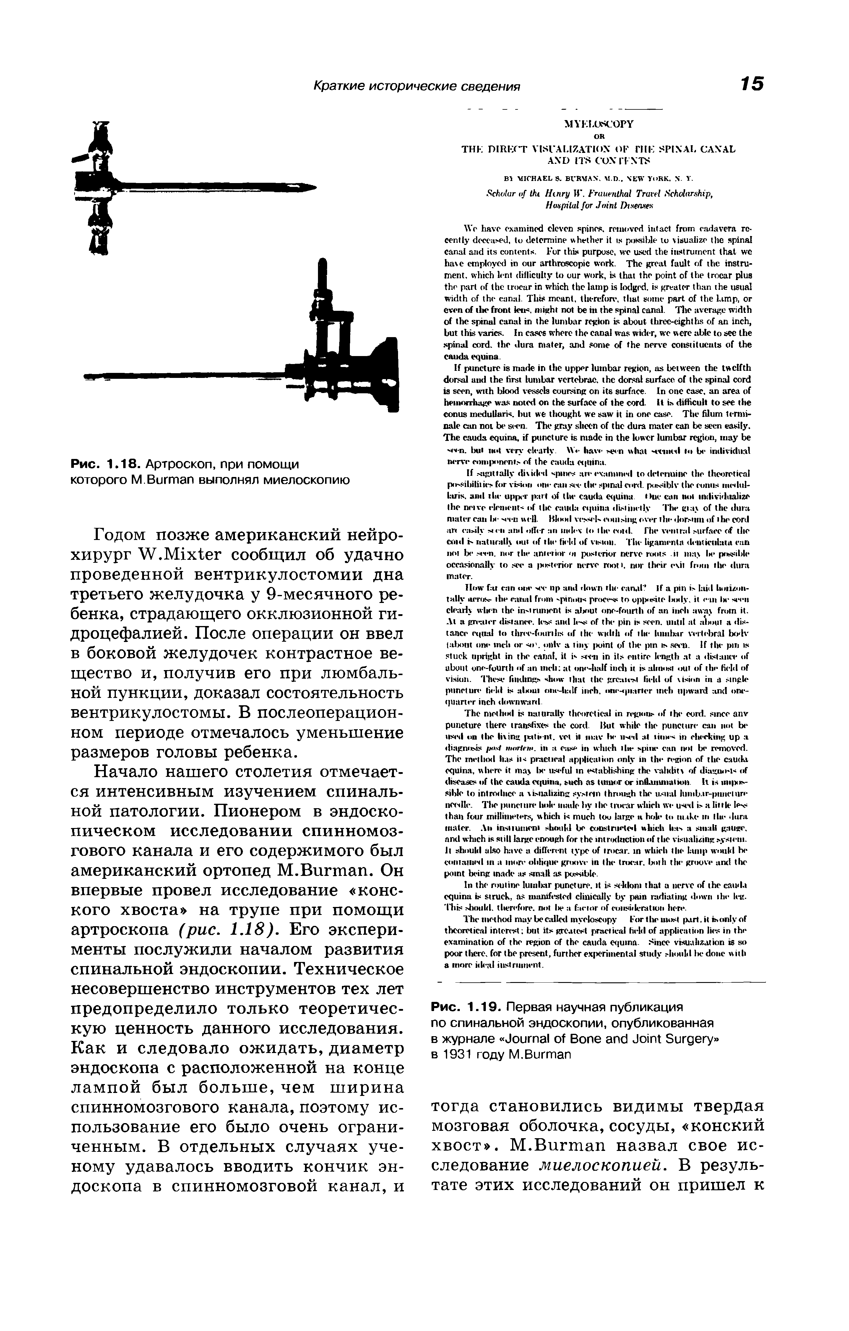 Рис. 1.19. Первая научная публикация по спинальной эндоскопии, опубликованная в журнале J B J S в 1931 году M.B ...