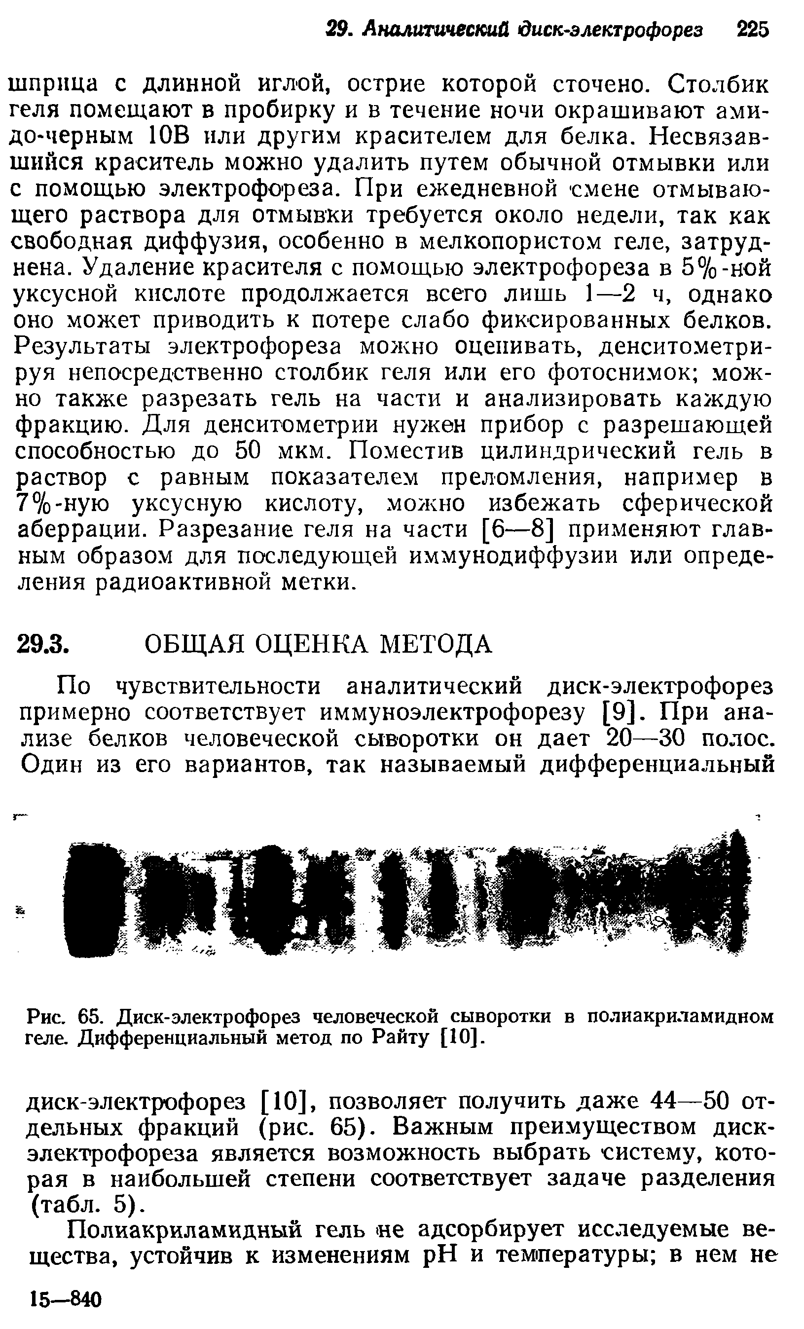 Рис. 65. Диск-электрофорез человеческой сыворотки в полиакриламидном геле. Дифференциальный метод по Райту [10].