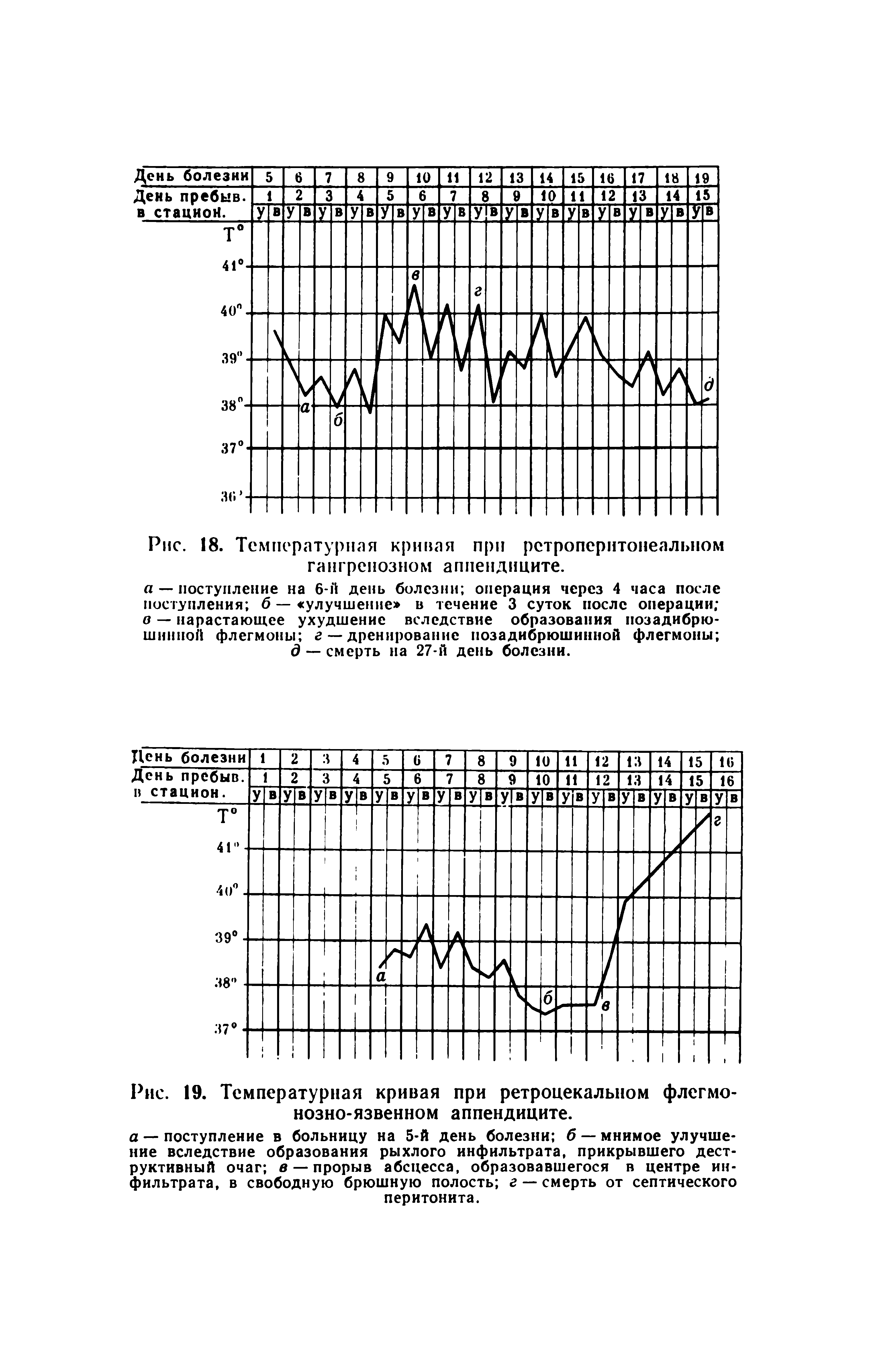 Рис. 19. Температурная кривая при ретроцекальном флегмонозно-язвенном аппендиците.