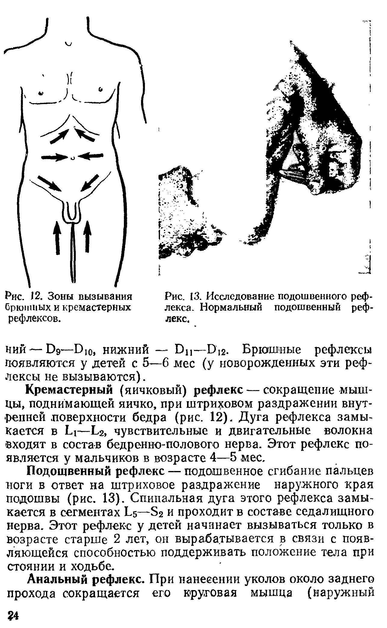 Рис. 13. Исследование подошвенного рефлекса. Нормальный подошвенный рефлекс.