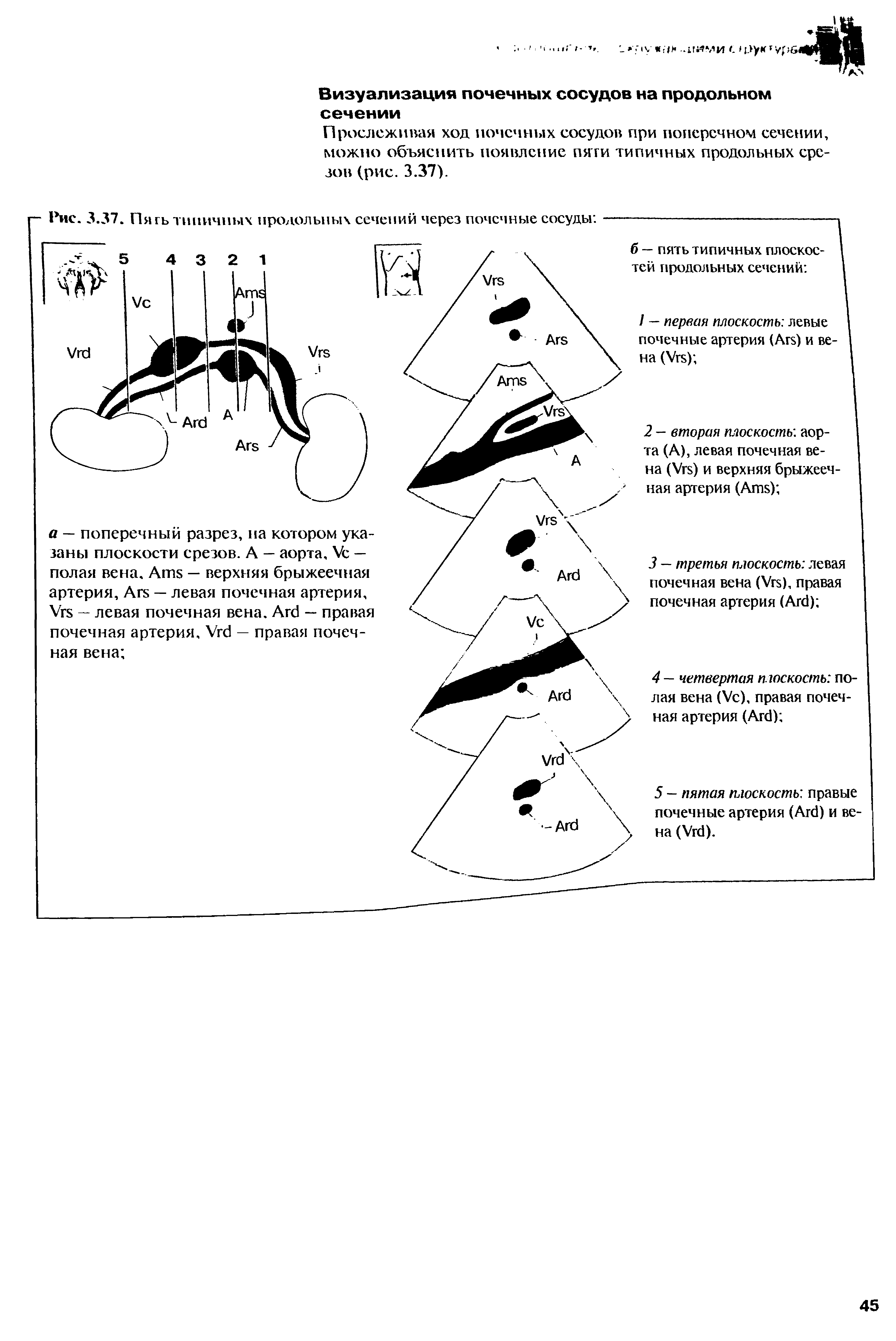 Рис. 3.37. Пять типичных продольных сечений через почечные сосуды ...
