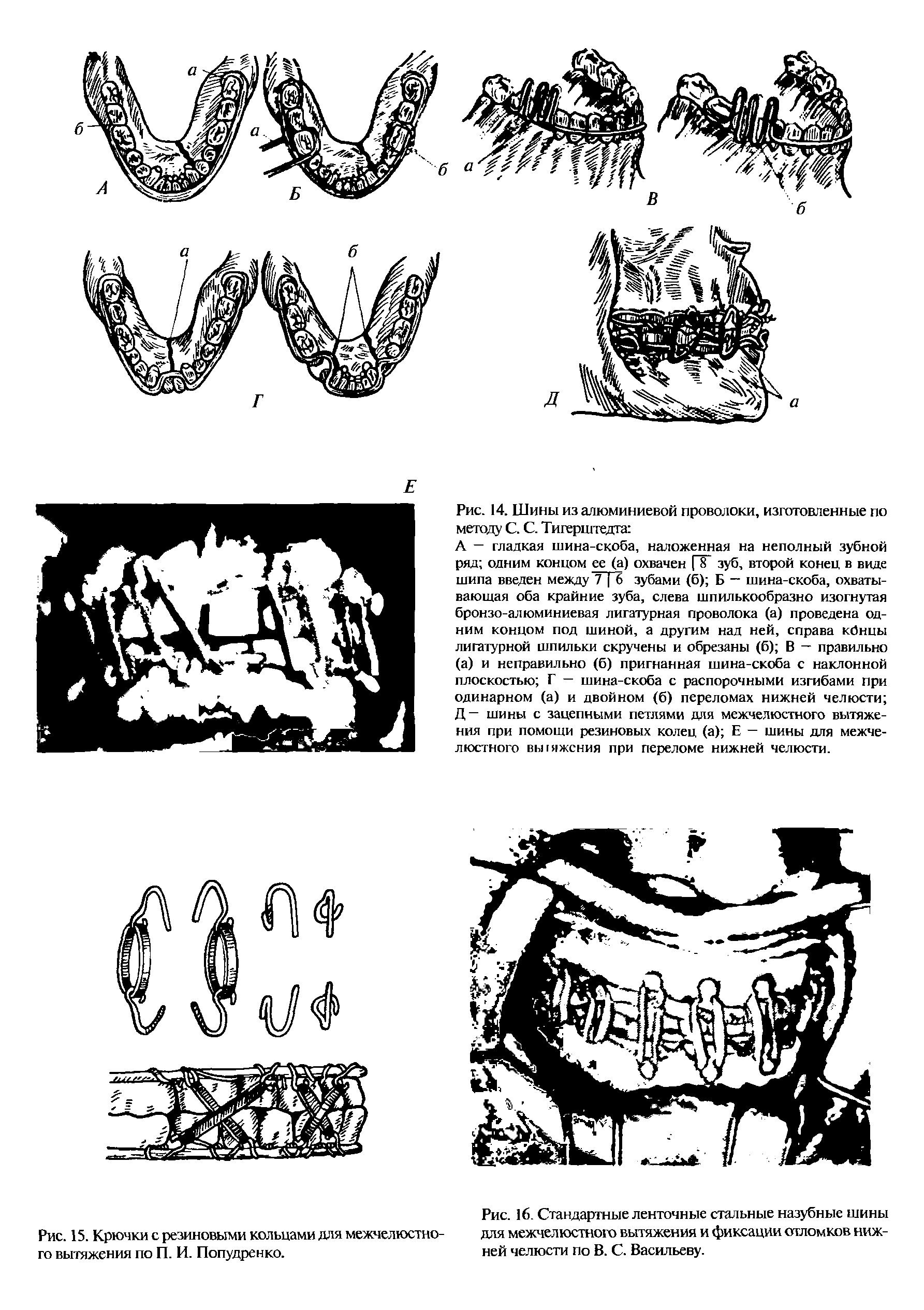 Рис. 14. Шины из алюминиевой проволоки, изготовленные по методу С. С. Тигерштедта ...