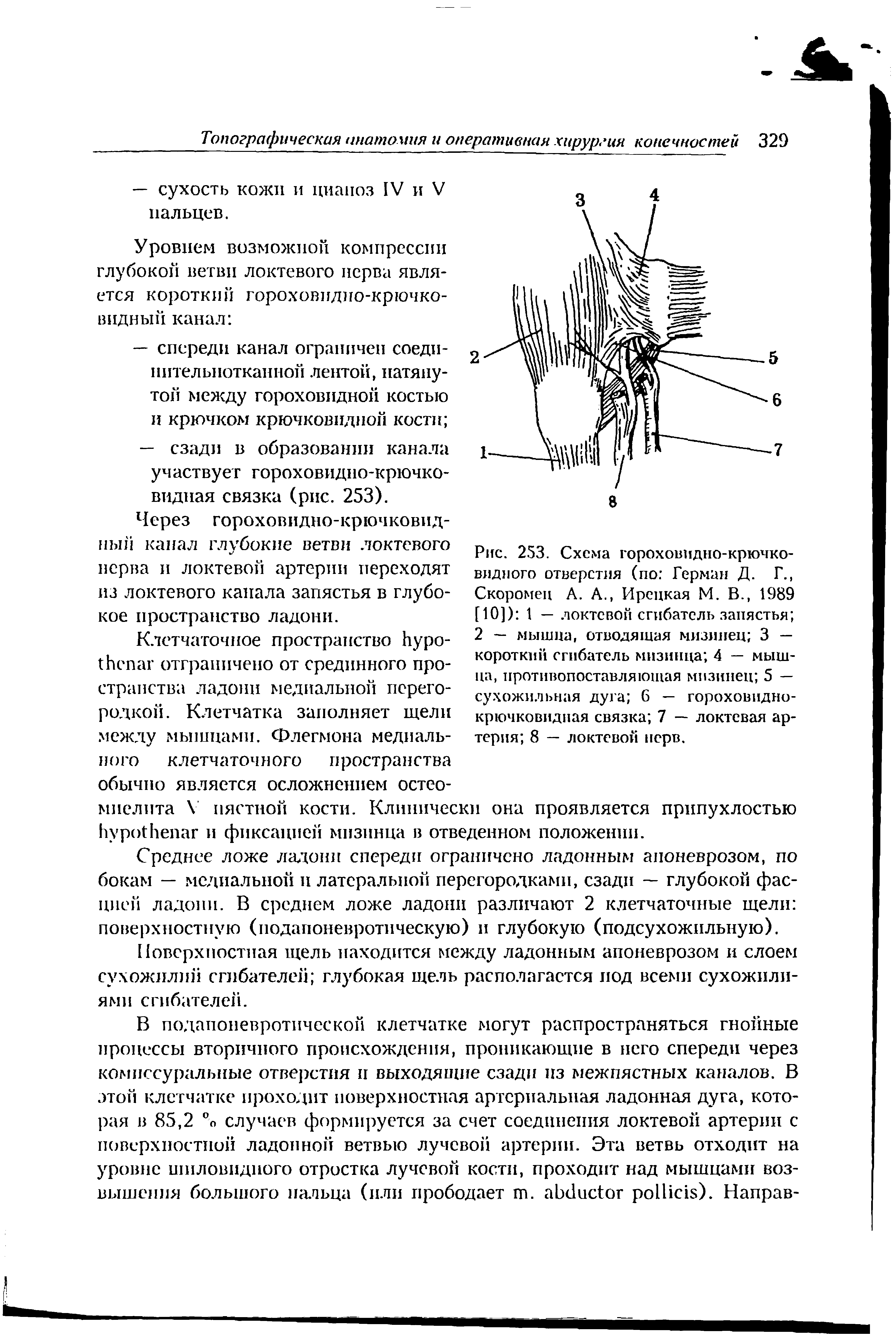 Рис. 253. Схема гороховидно-крючковидного отверстия (по Герман Д. Г., Скоромен А. А., Ирсцкая М. В., 1989 [10]) 1 — локтевой сгибатель запястья 2 — мышца, отводящая мизинец 3 — короткий сгибатель мизинца 4 — мышца, противопоставляющая мизинец 5 — сухожильная дуга 6 — гороховиднокрючковидная связка 7 — локтевая артерия 8 — локтевой нерв.