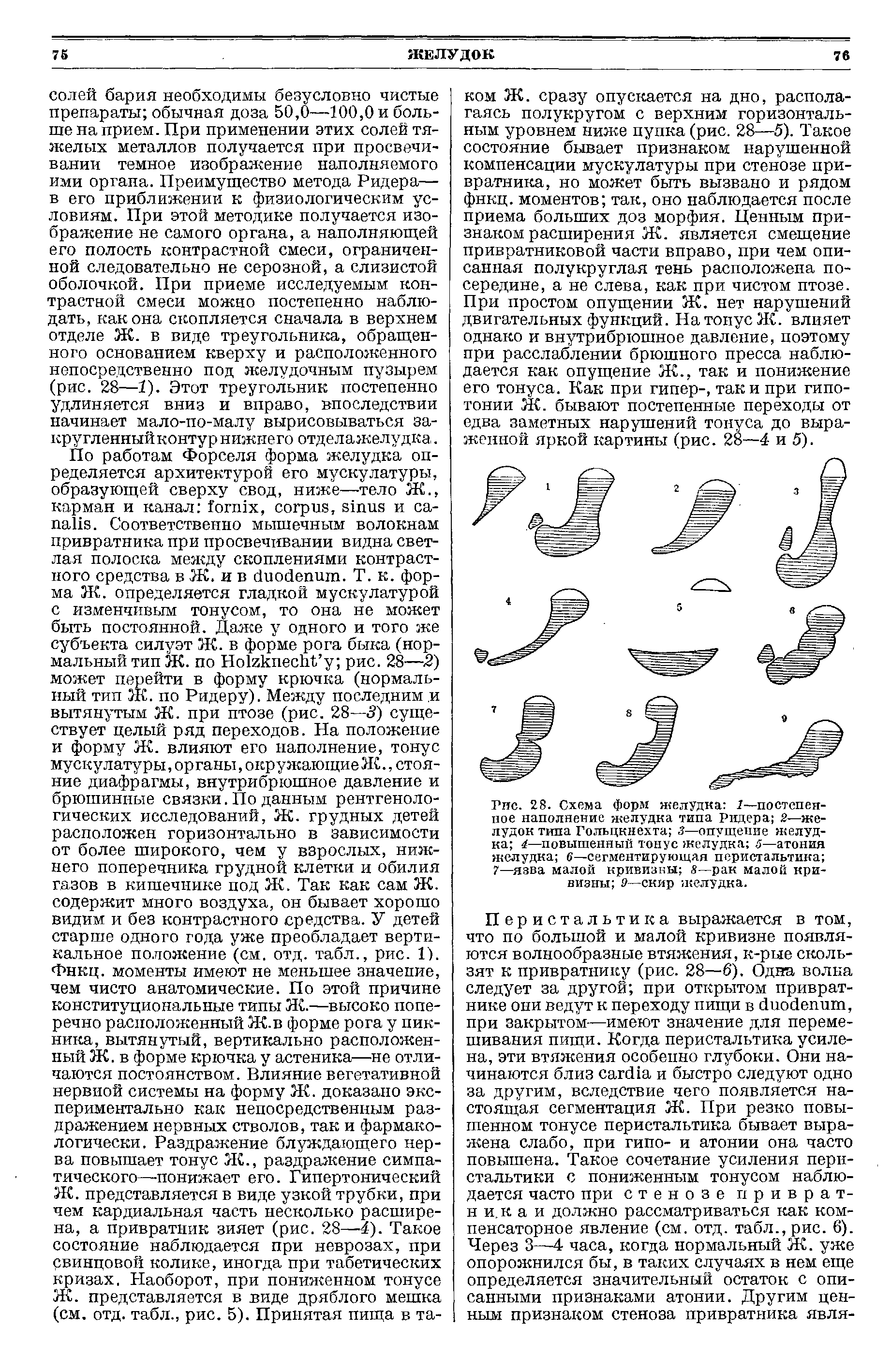 Рис. 28. Схема форм желудка 1—постелен-ное наполнение желудка типа Ридера 2—желудок типа Гольцкнехта 3—опущение желудка 4—повышенный тонус желудка 5—атония желудка 6—сегментирующая перистальтика 7—язва малой кривизны S—рак малой кривизны 9—скир желудка.