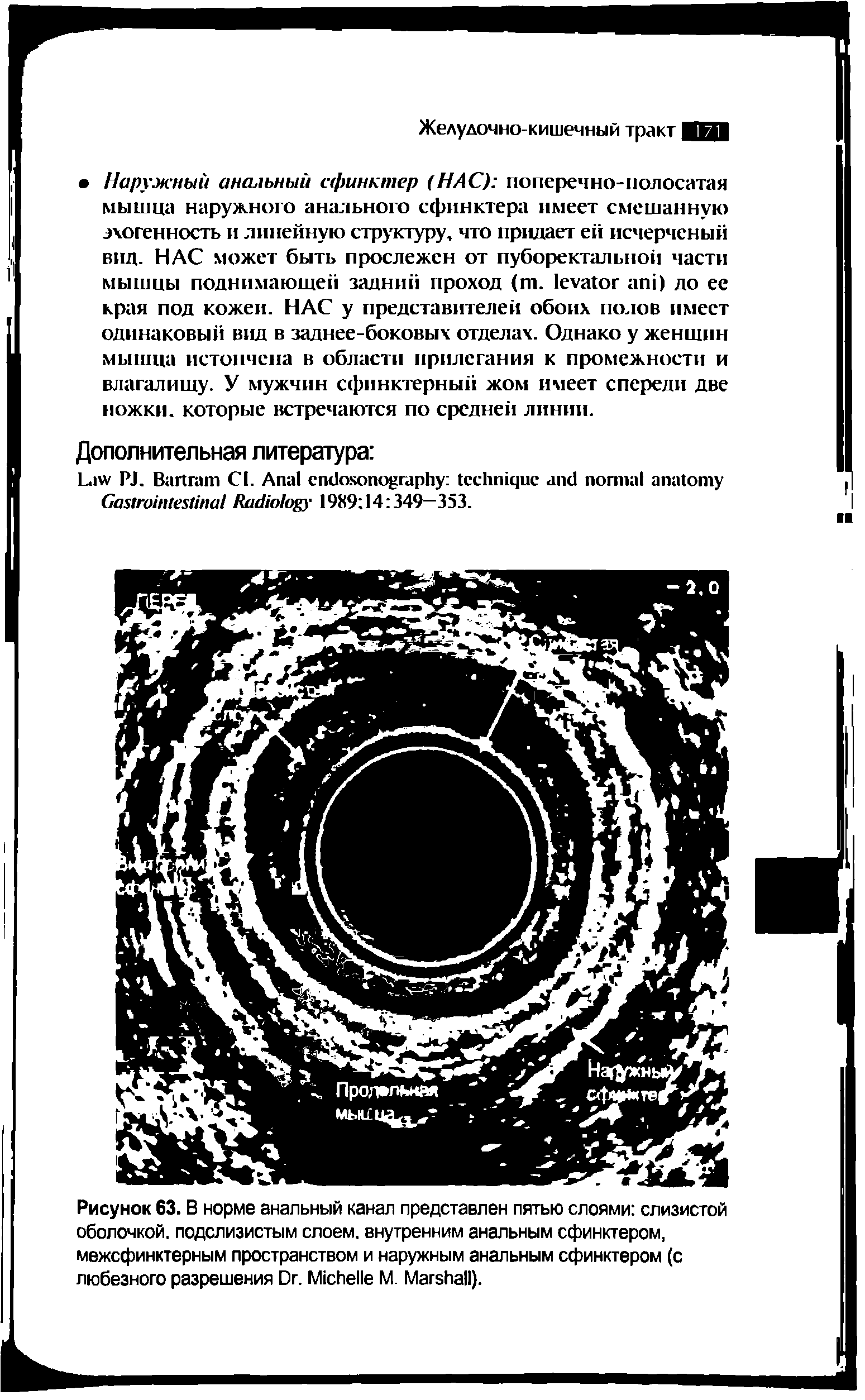 Рисунок 63. В норме анальный канал представлен пятью слоями слизистой оболочкой, подслизистым слоем, внутренним анальным сфинктером, межсфинктерным пространством и наружным анальным сфинктером (с любезного разрешения D . M М. M ).