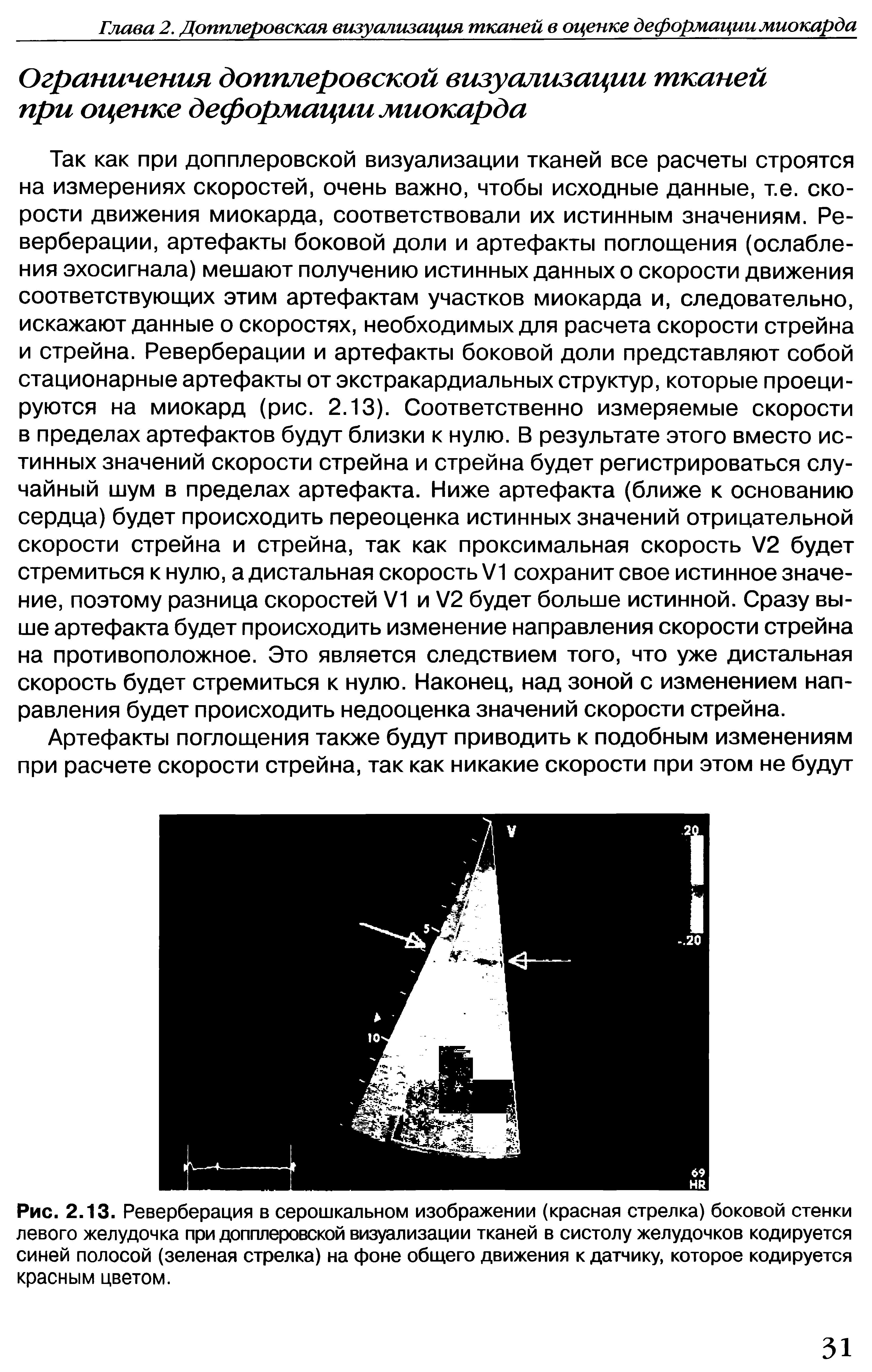 Рис. 2.13. Реверберация в серошкальном изображении (красная стрелка) боковой стенки левого желудочка при допплеровской визуализации тканей в систолу желудочков кодируется синей полосой (зеленая стрелка) на фоне общего движения к датчику, которое кодируется красным цветом.