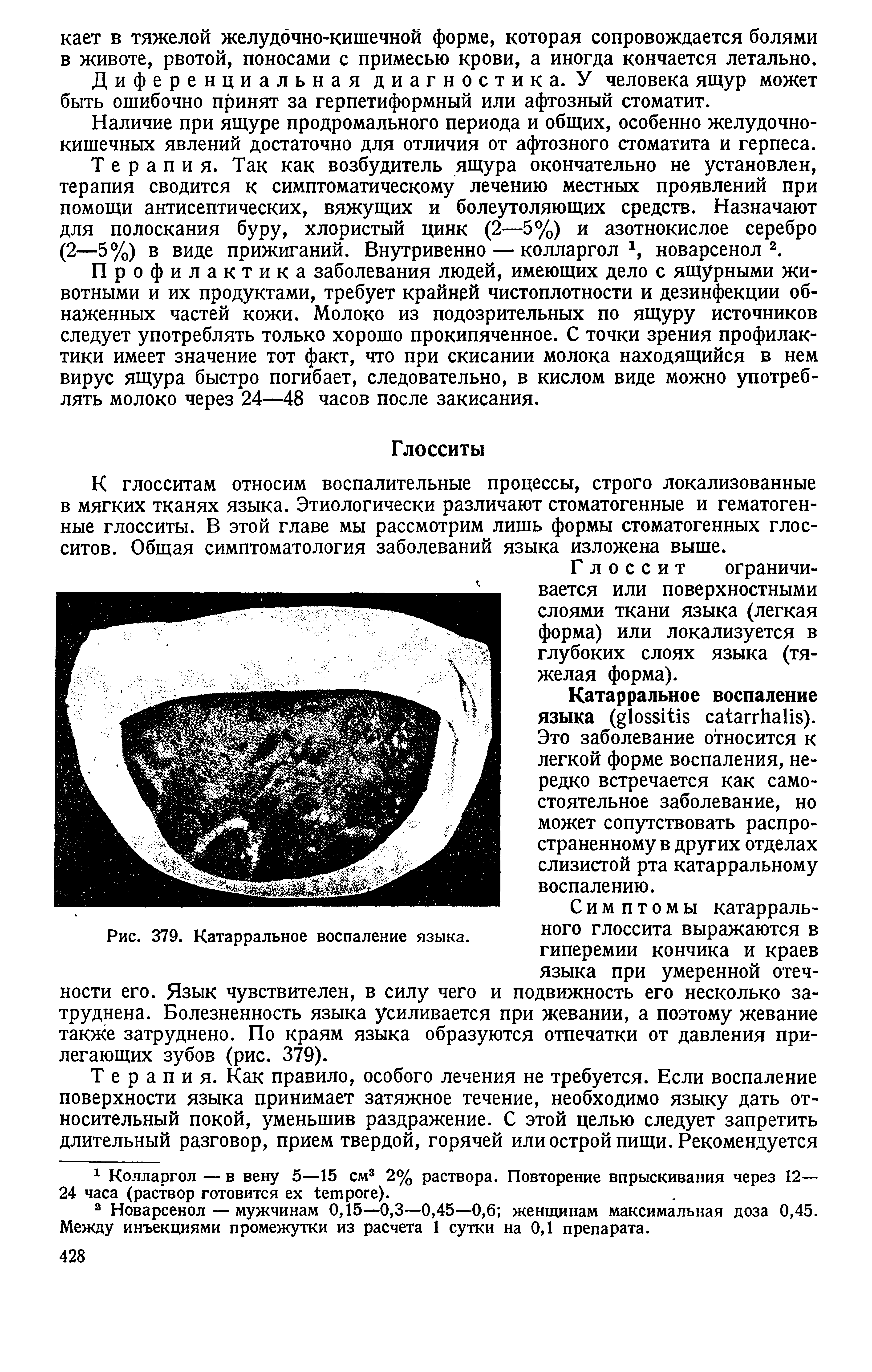 Рис. 379. Катарральное воспаление языка. НОГО глоссита выражаются В...