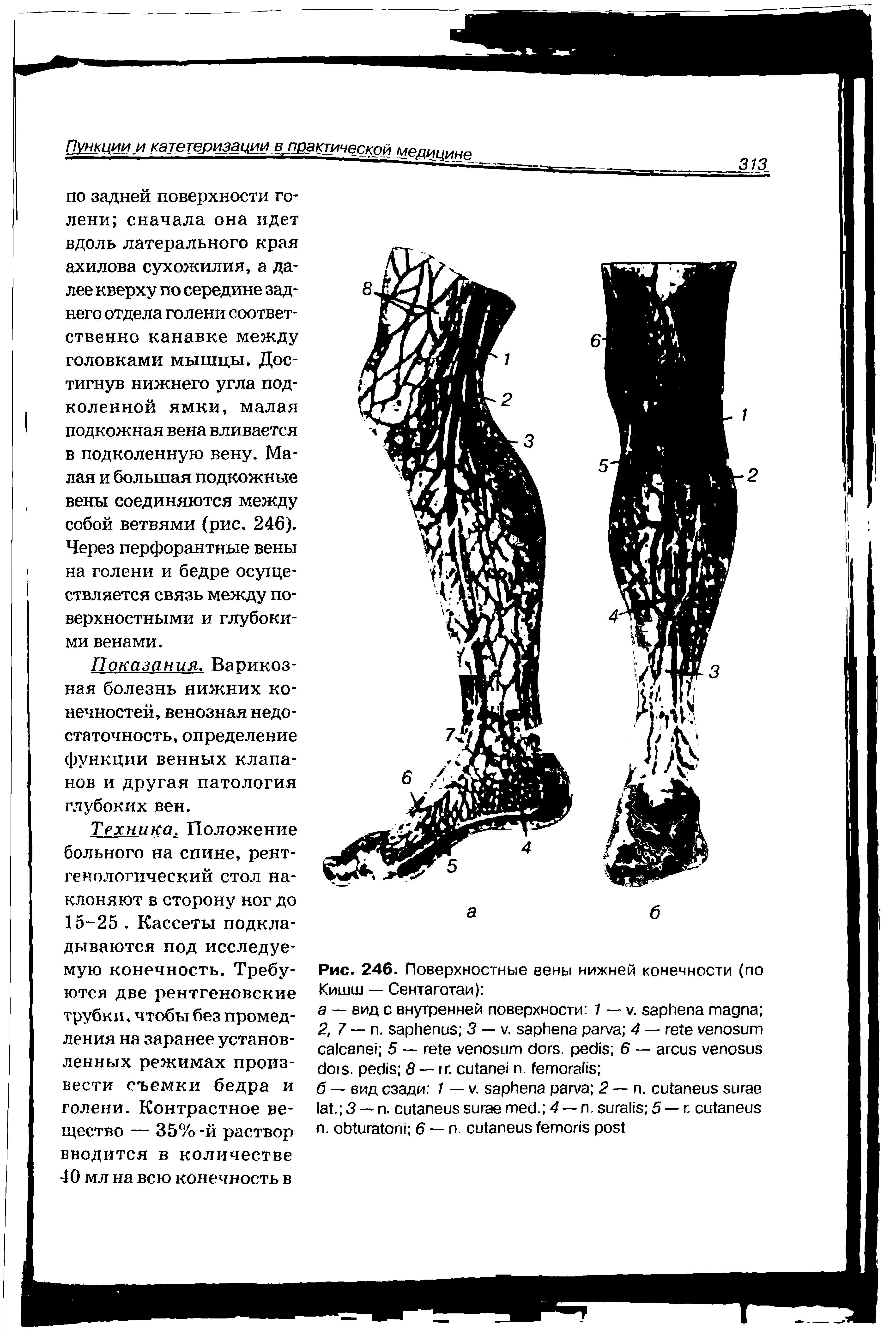 Рис. 246. Поверхностные вены нижней конечности (по Кишт — Сентаготаи) ...