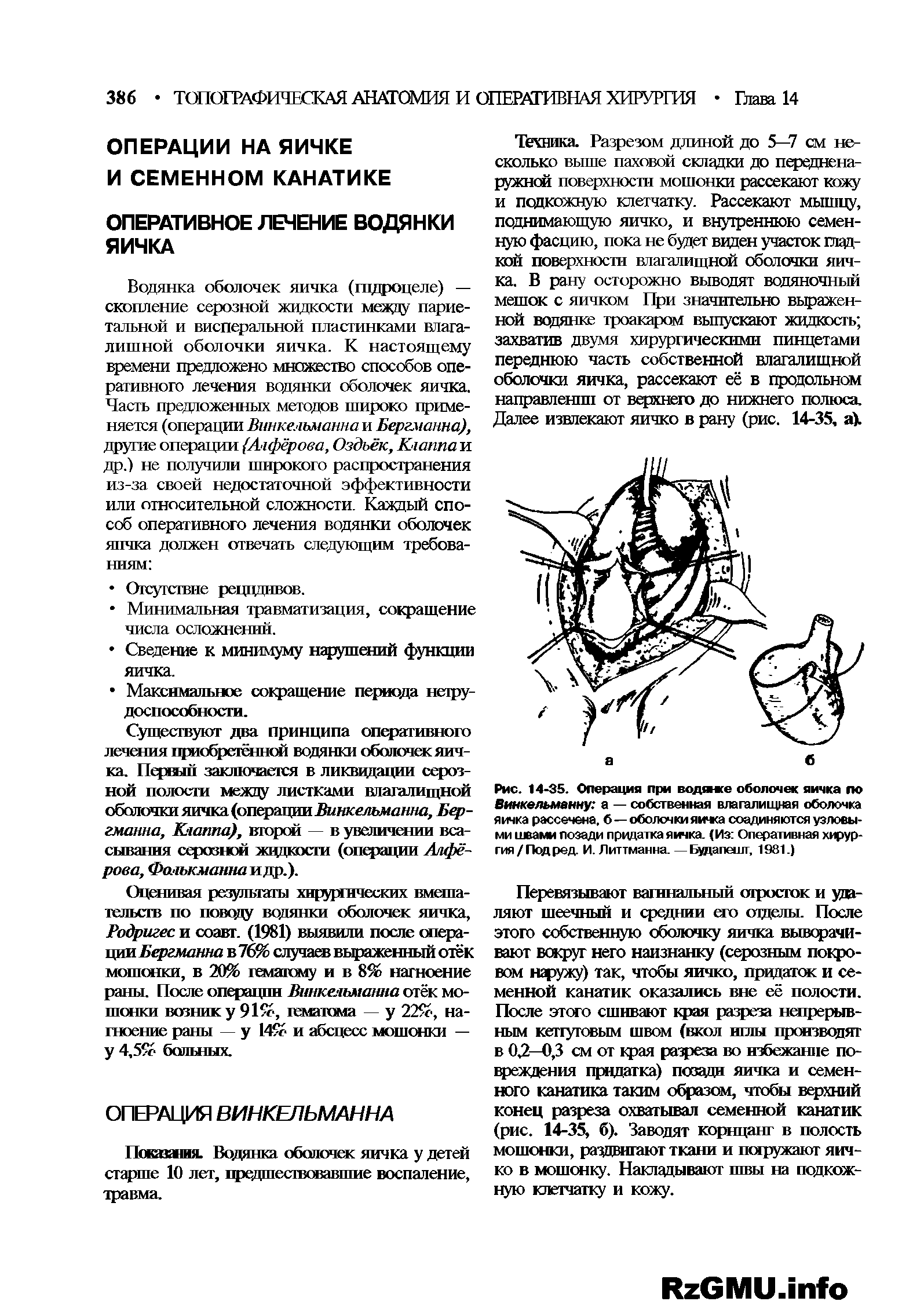Рис. 14-35. Операция при водянсе оболочек яичка по Винкельманну а — собственная влагалищная оболочка яичка рассечена, б—оболочки яичса соединяются узловыми швами позади придатка яичка. (Из Оперативная хирургия/Под ред. И. Литтманна. —Будапешт, 1981.)...